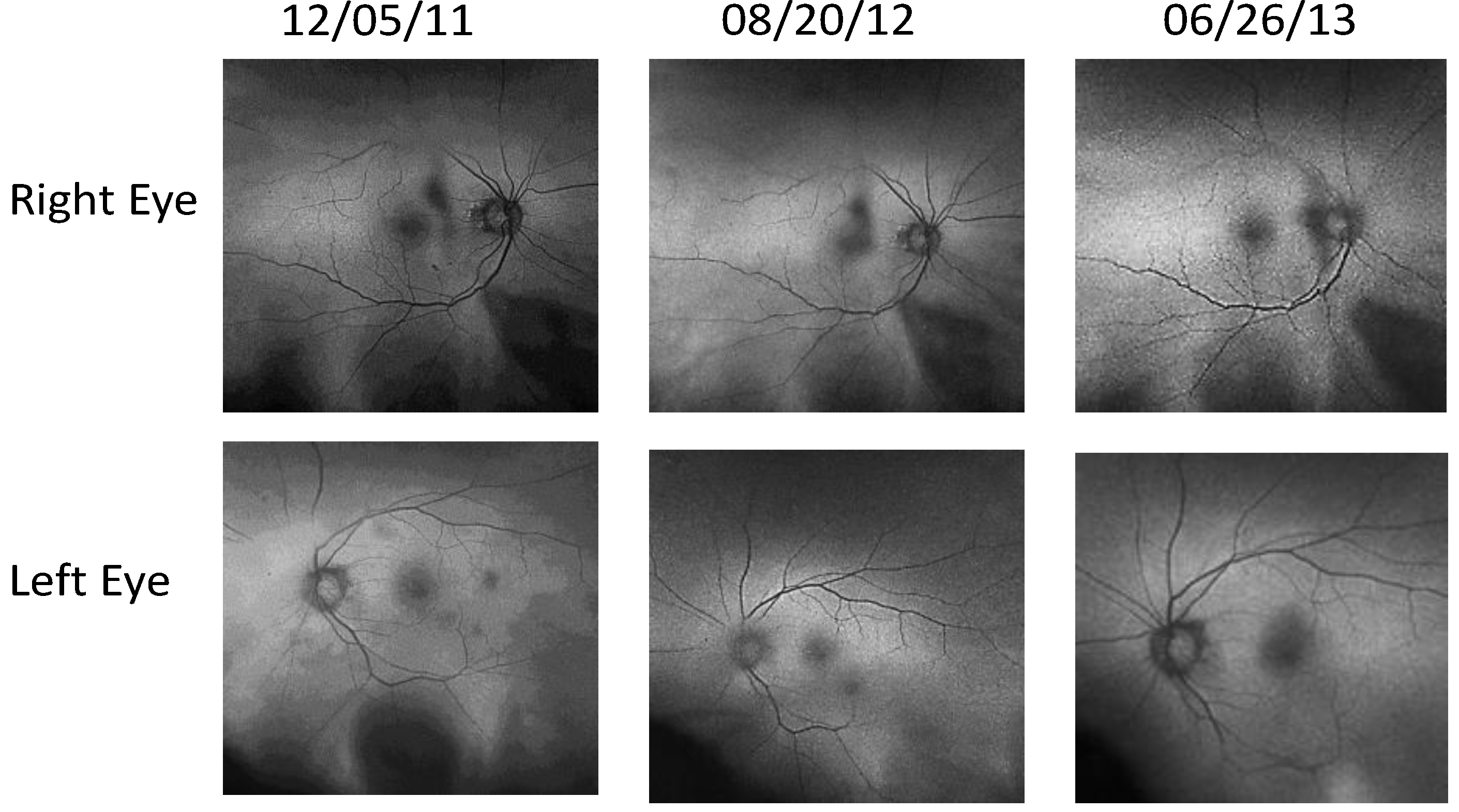 Nutrients 06 04404 g005