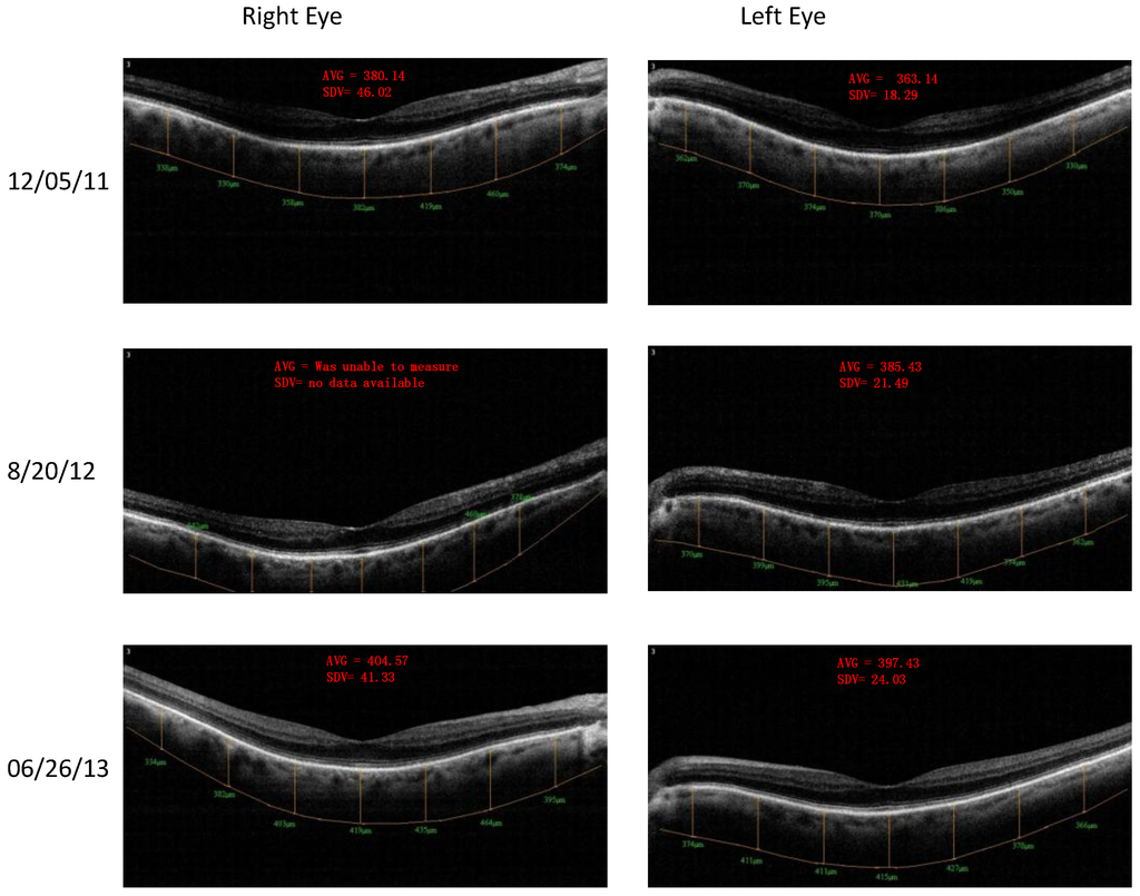 Nutrients 06 04404 g006 1024
