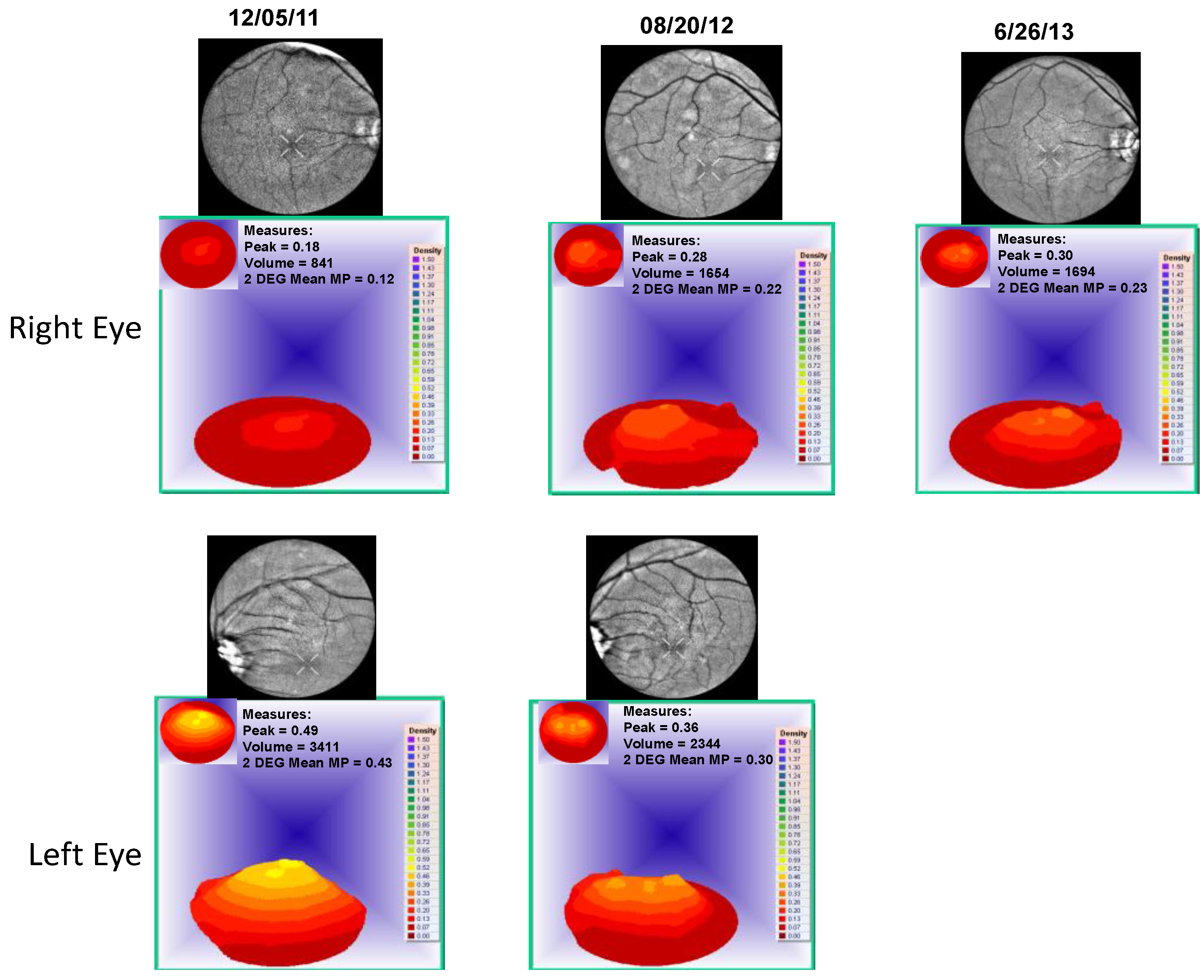 Nutrients 06 04404 g007
