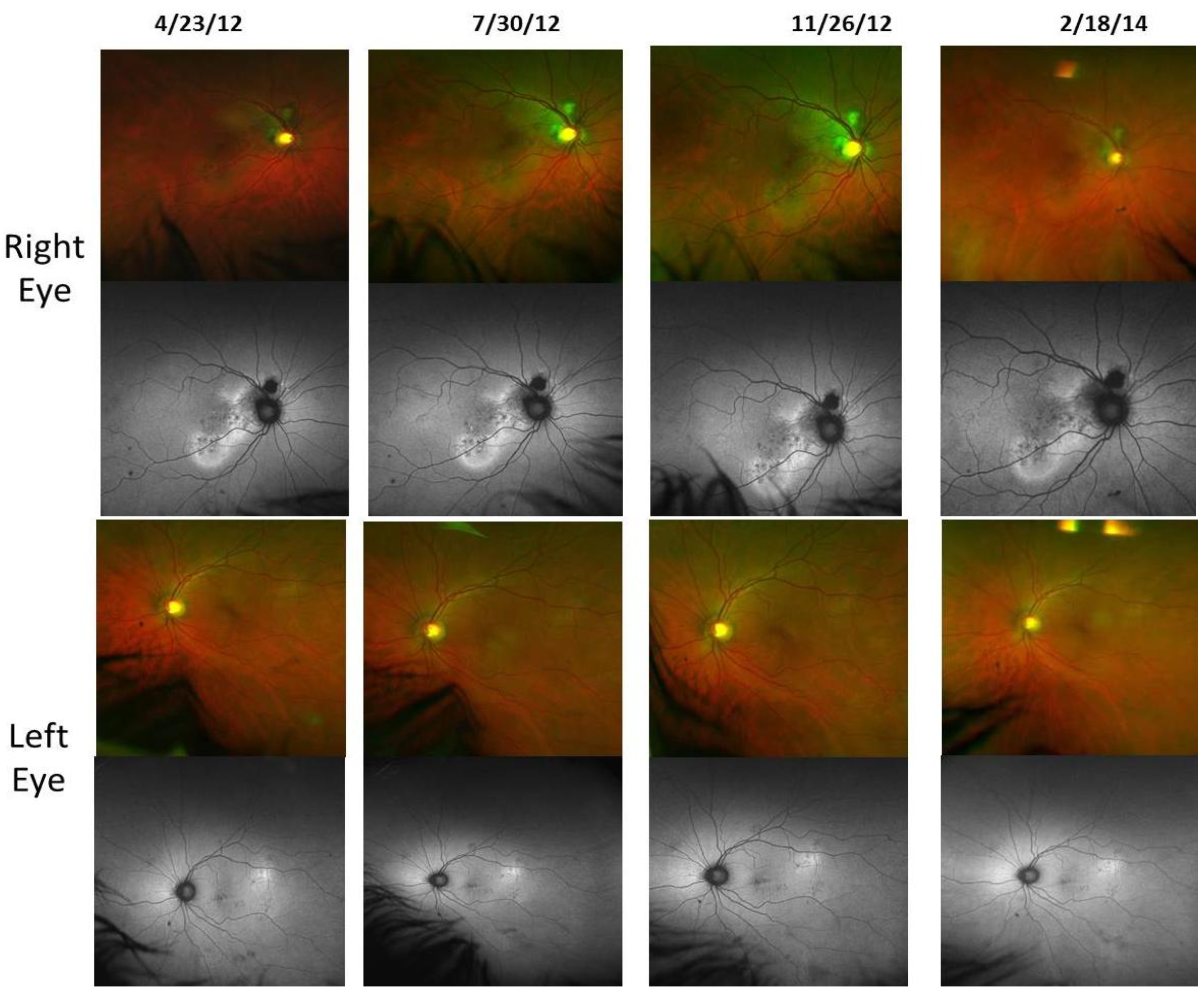 Nutrients 06 04404 g009