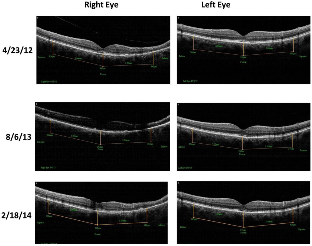 Nutrients 06 04404 g010 1024