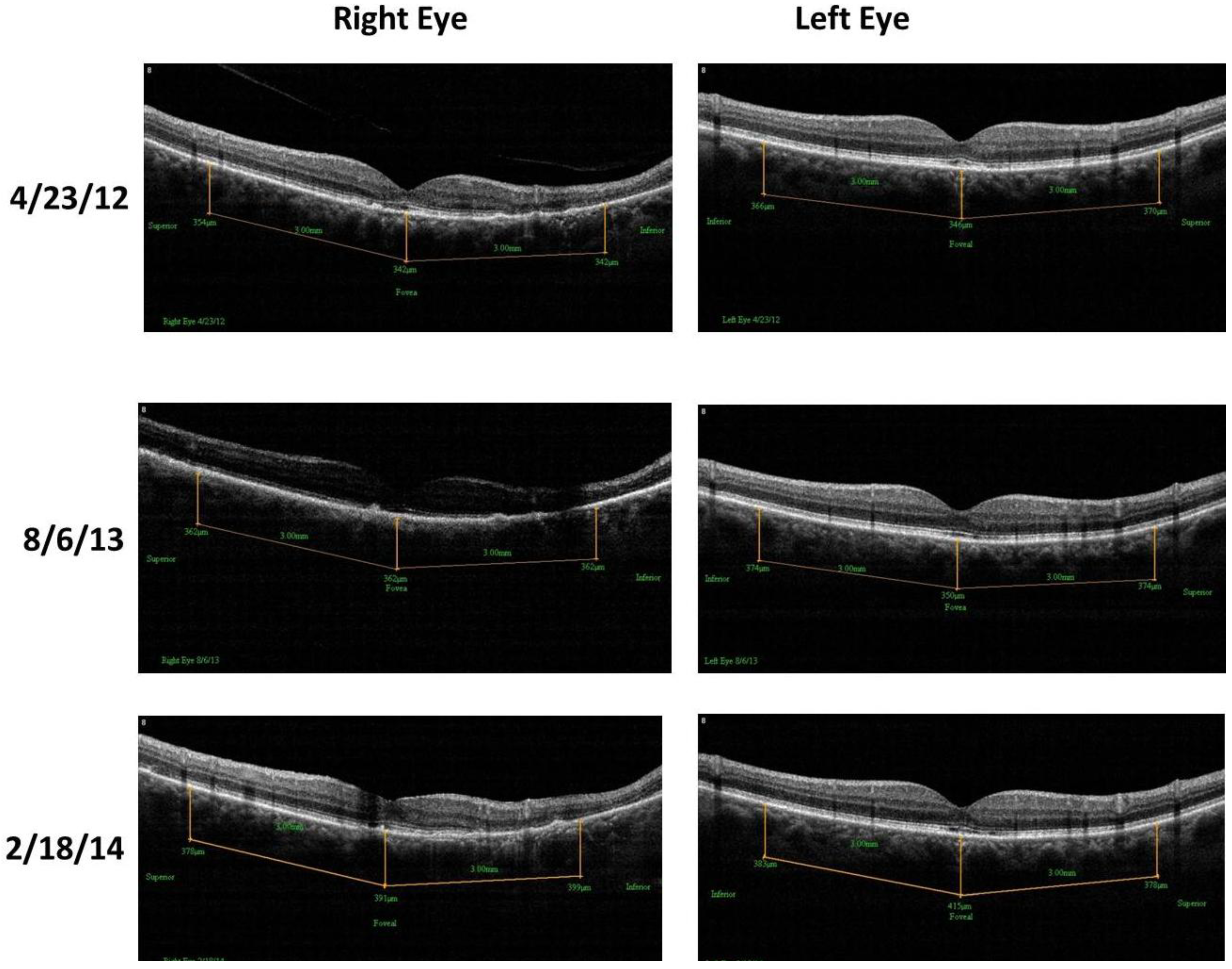 Nutrients 06 04404 g010