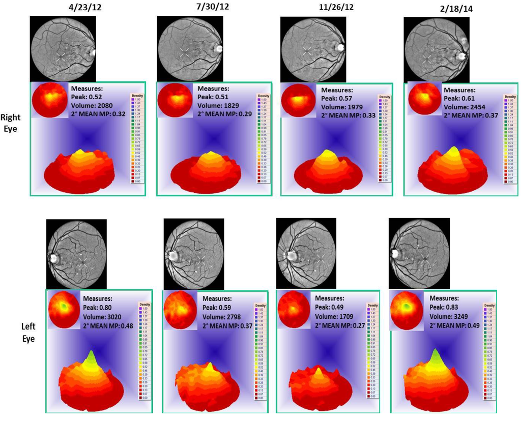 Nutrients 06 04404 g011 1024