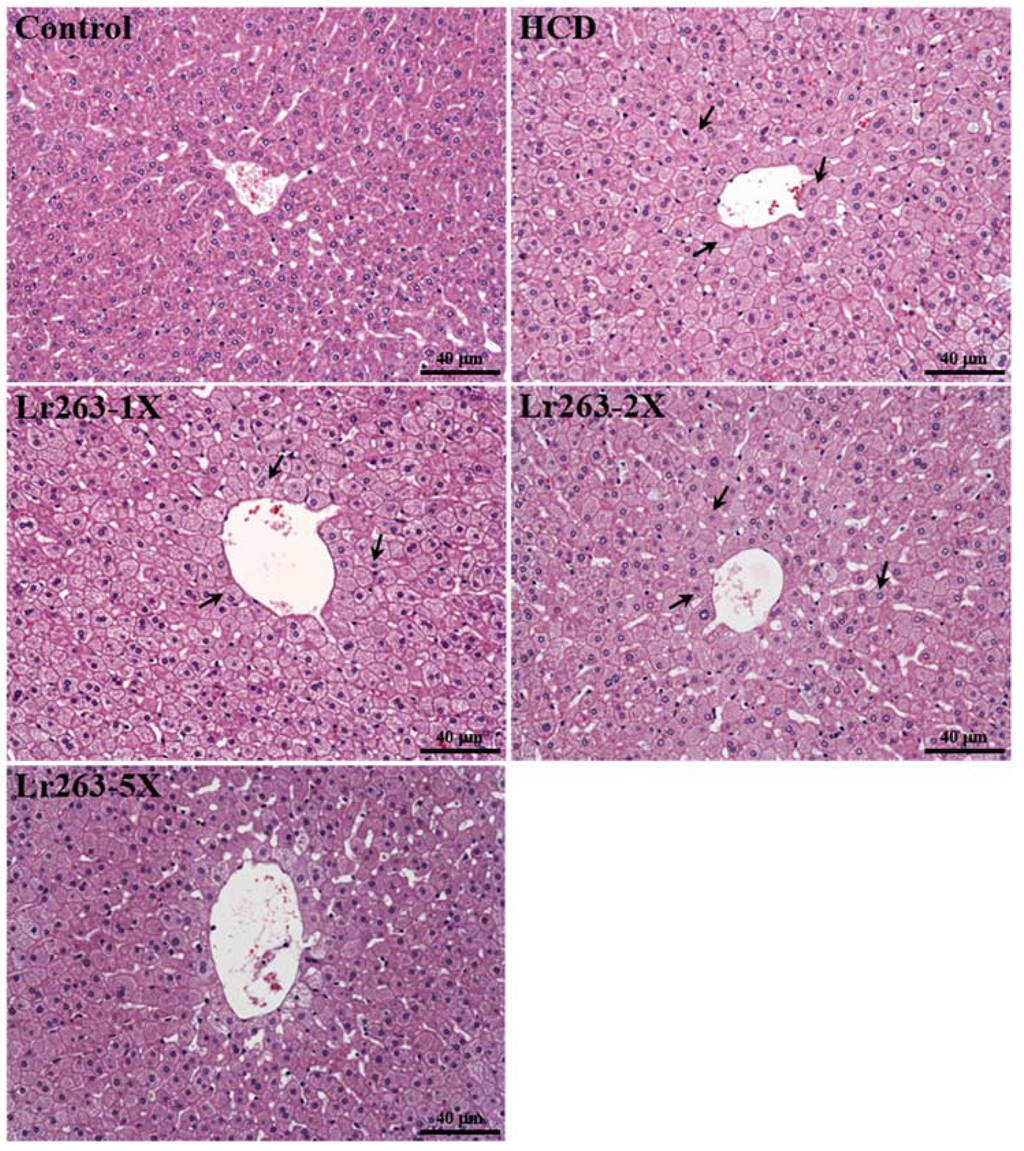 Nutrients 07 03767 g007 1024