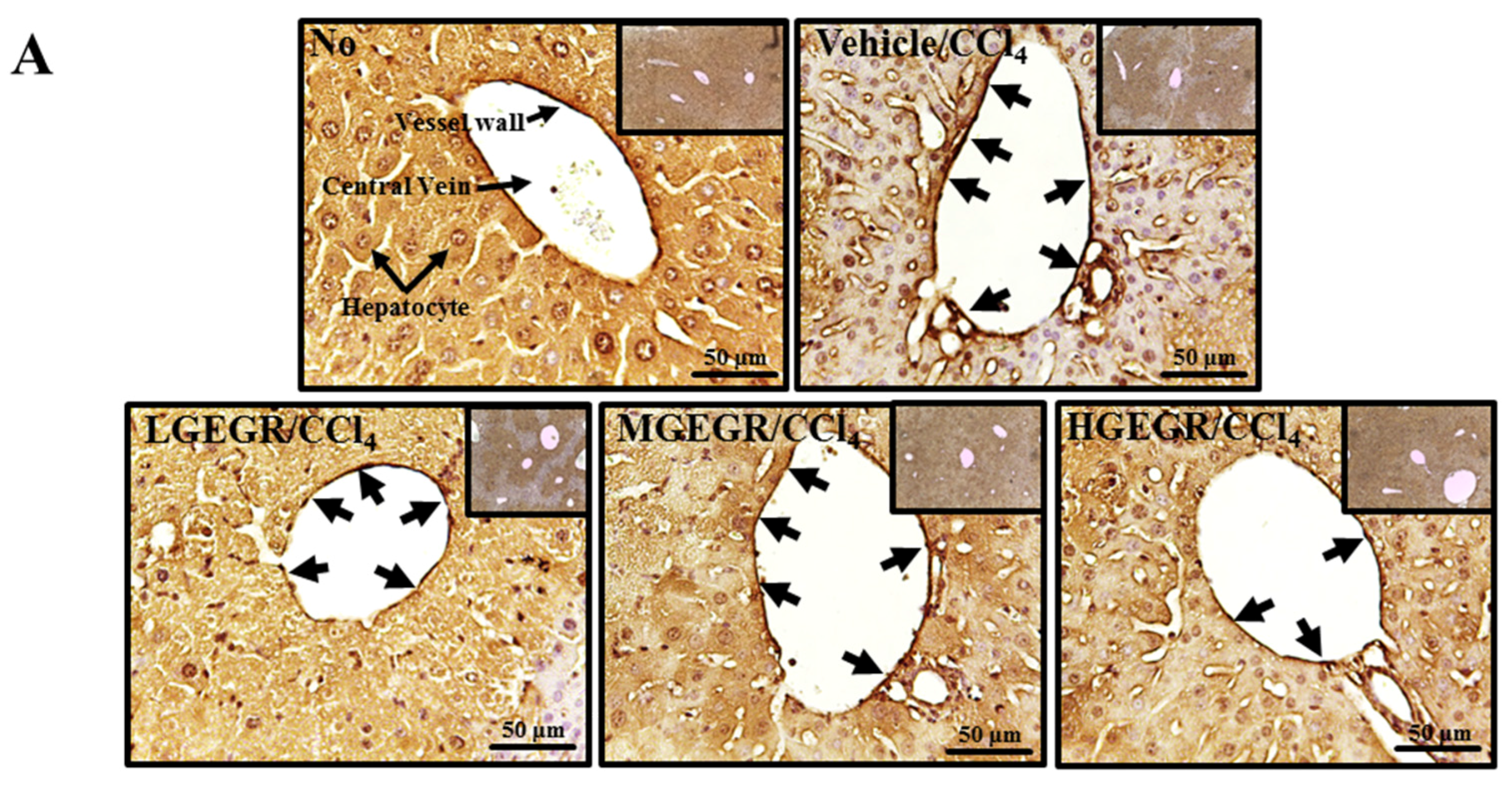 Nutrients 08 00107 g006a