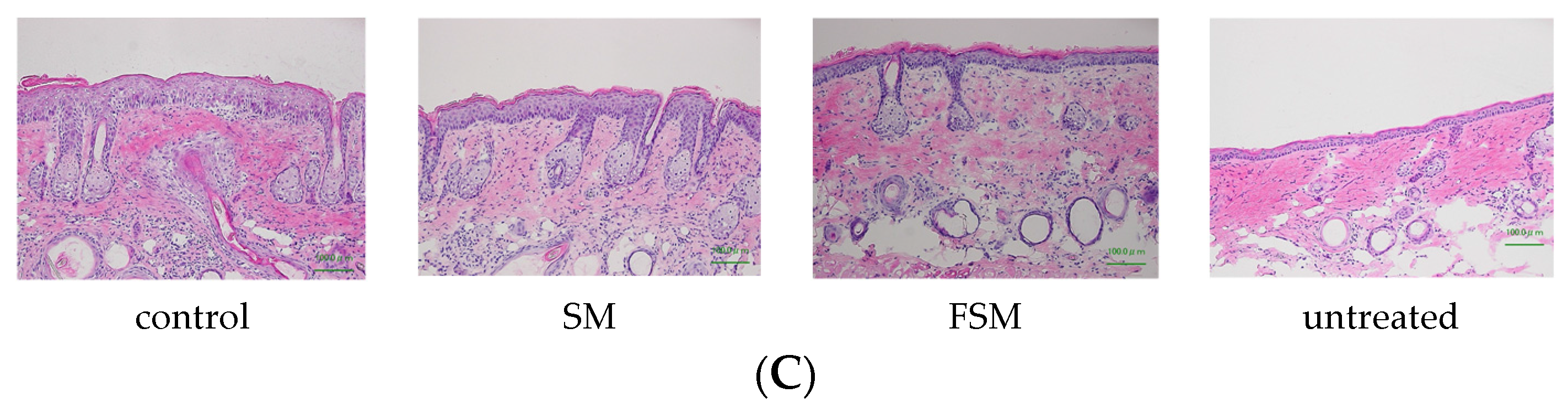 Nutrients 08 00514 g004b