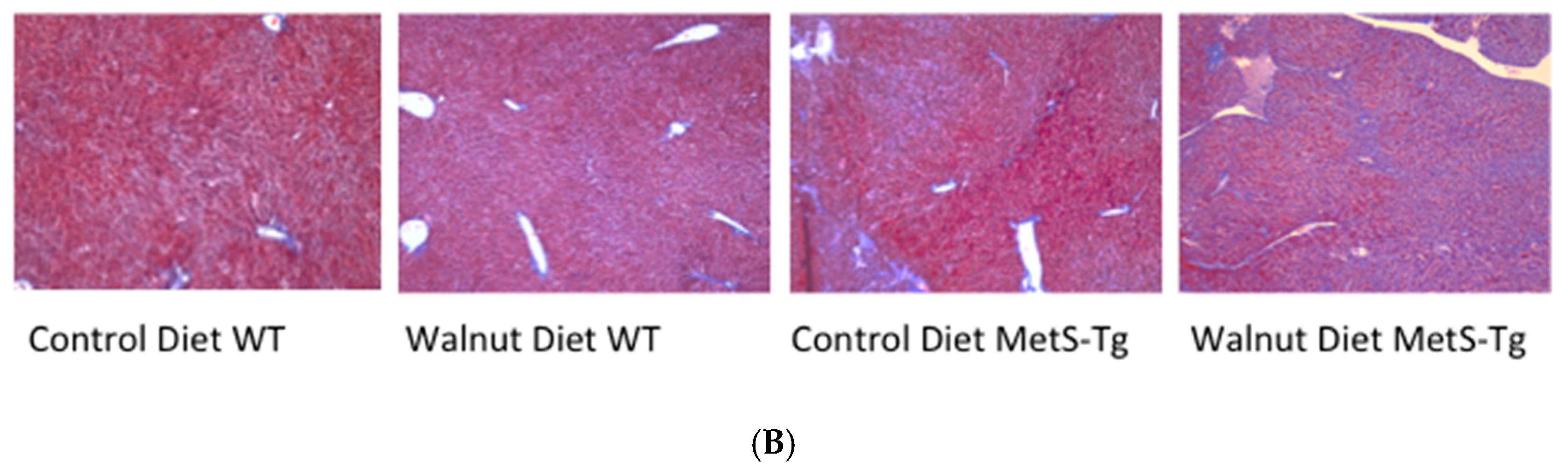 Nutrients 09 00722 g002b
