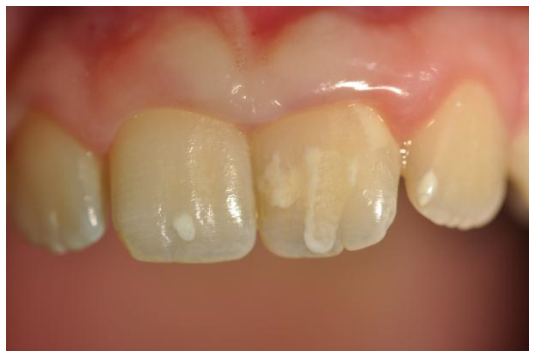 Nutrients 09 01321 g002