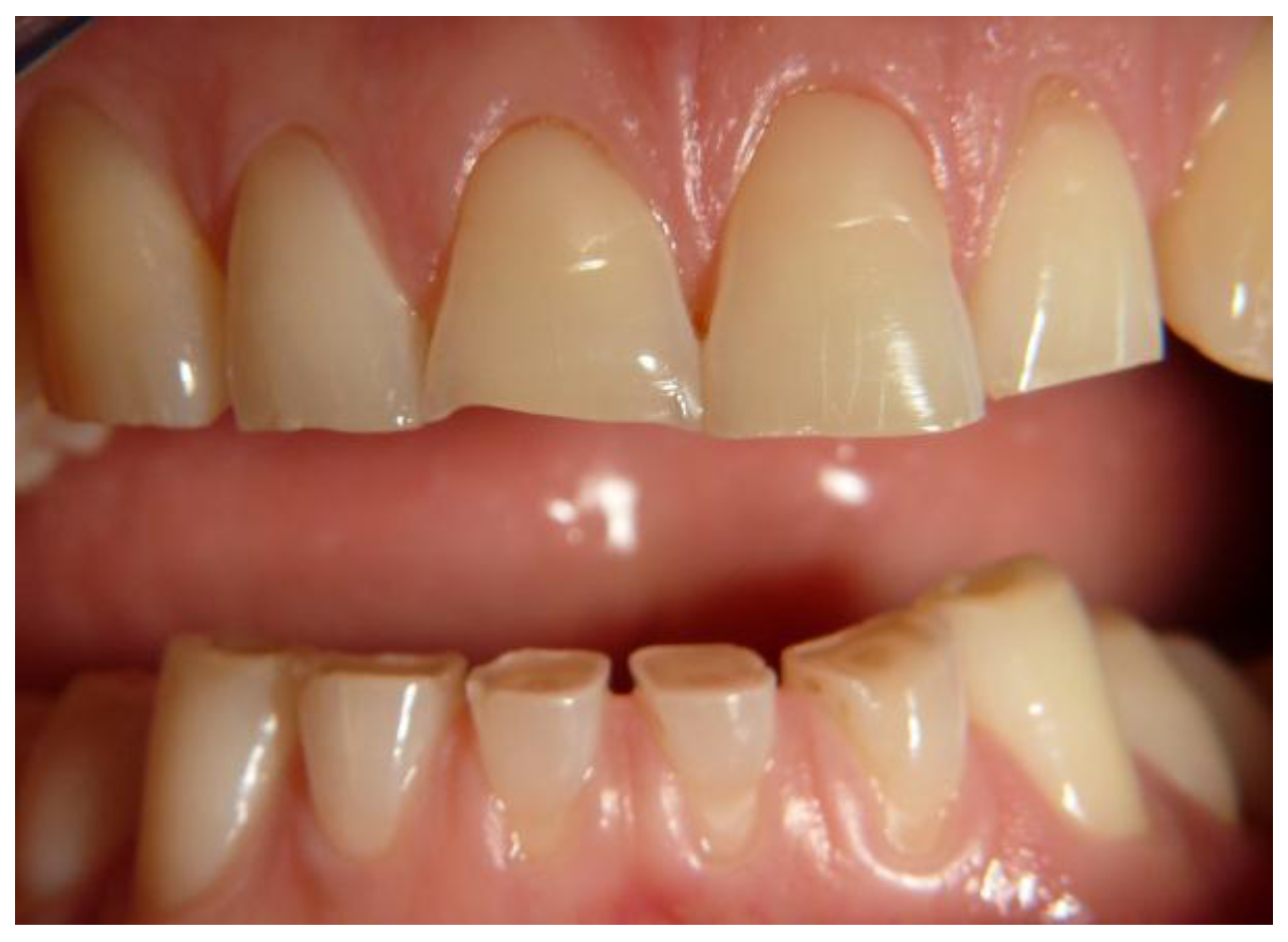 Nutrients 09 01321 g003