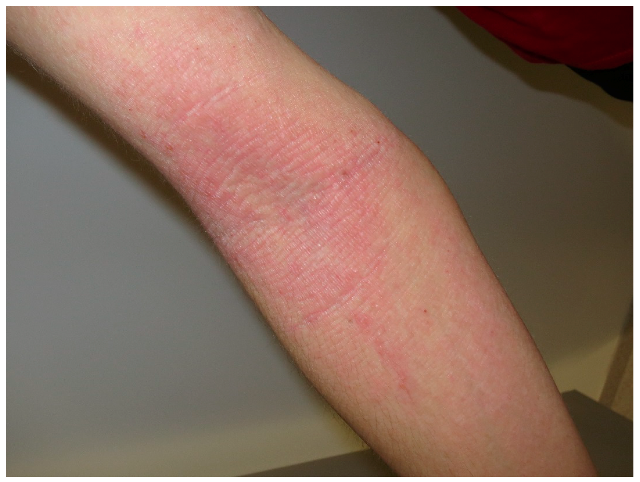 Nutrients 10 00800 g002