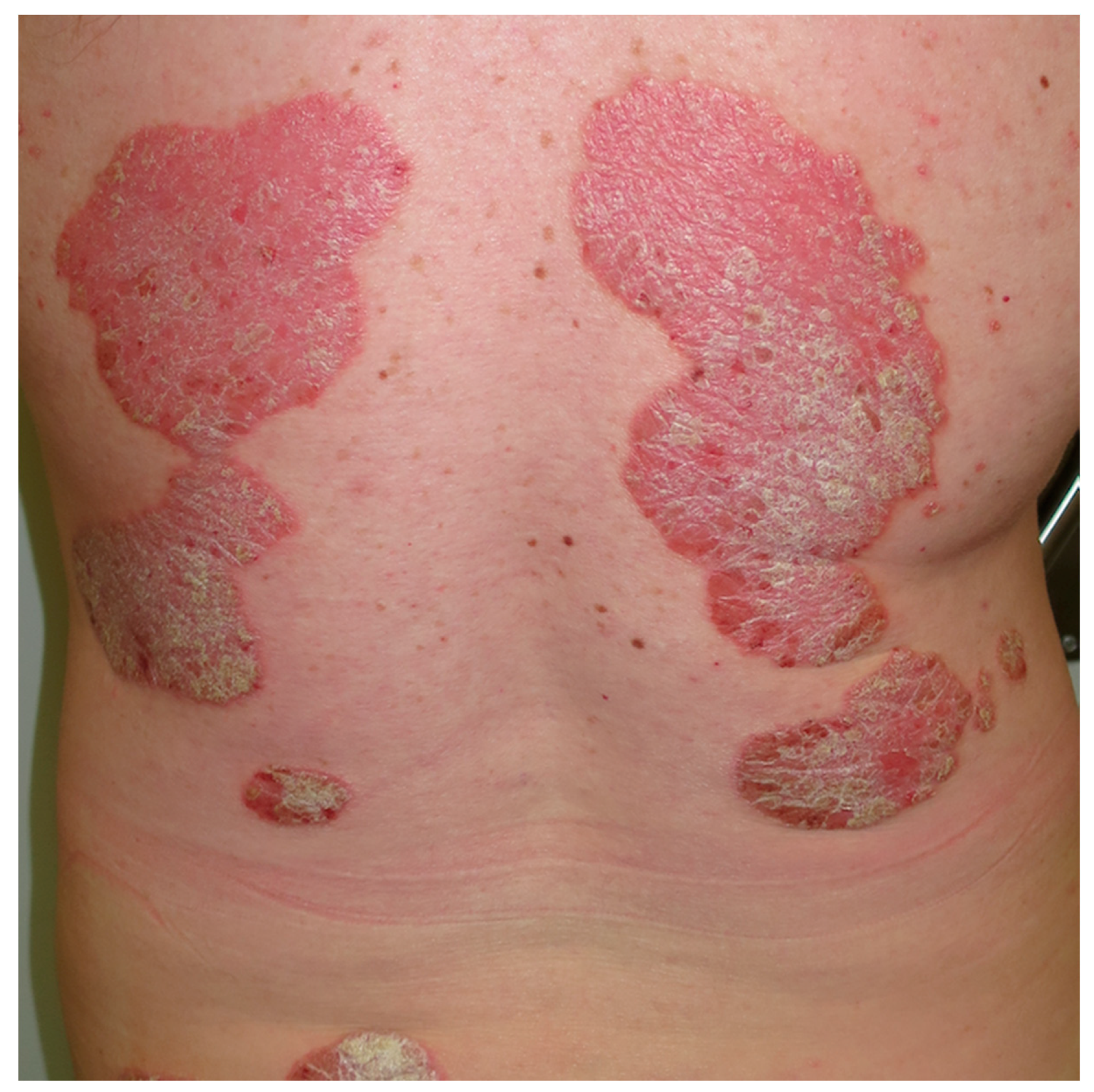 Nutrients 10 00800 g004