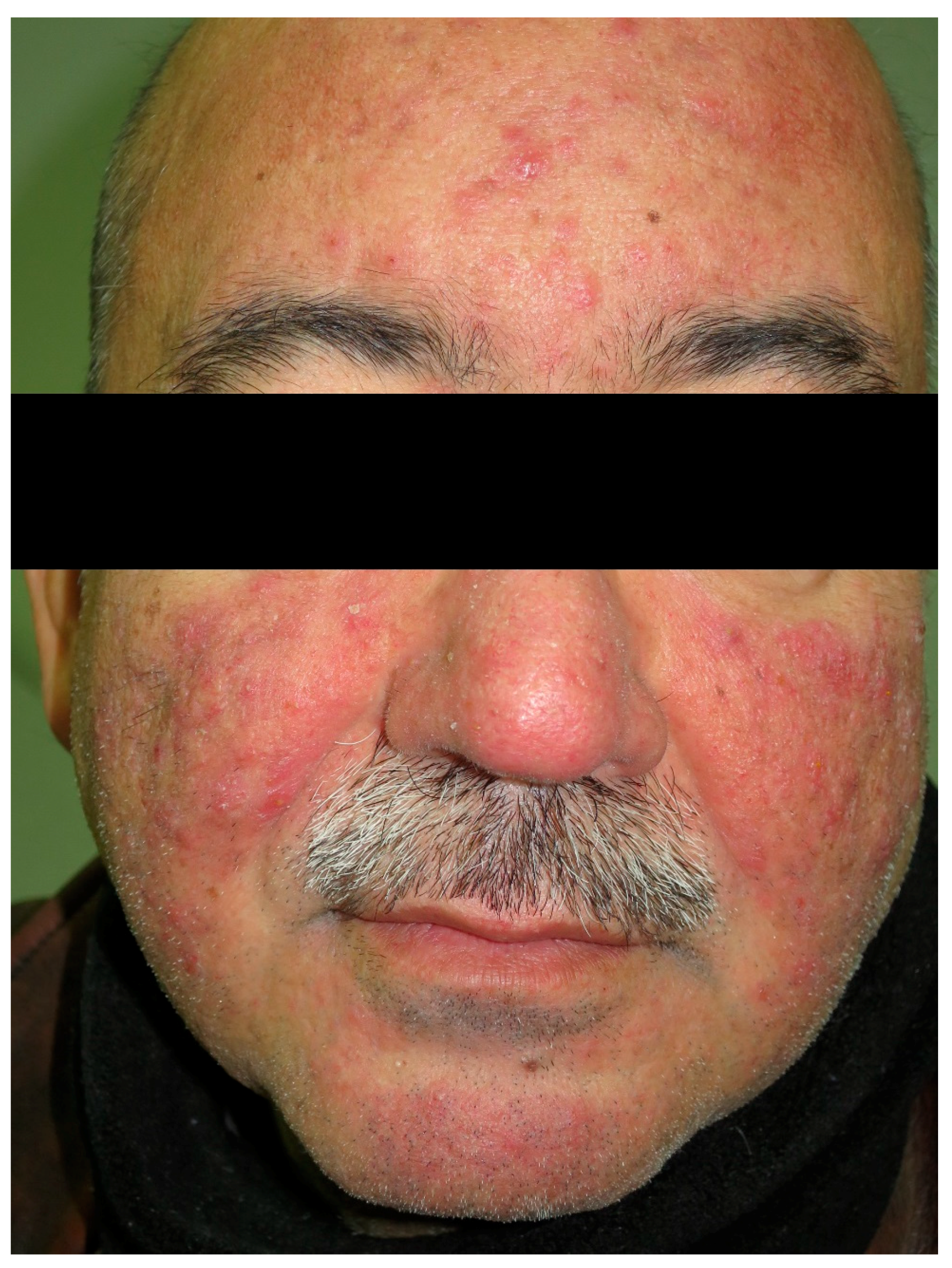 Nutrients 10 00800 g006