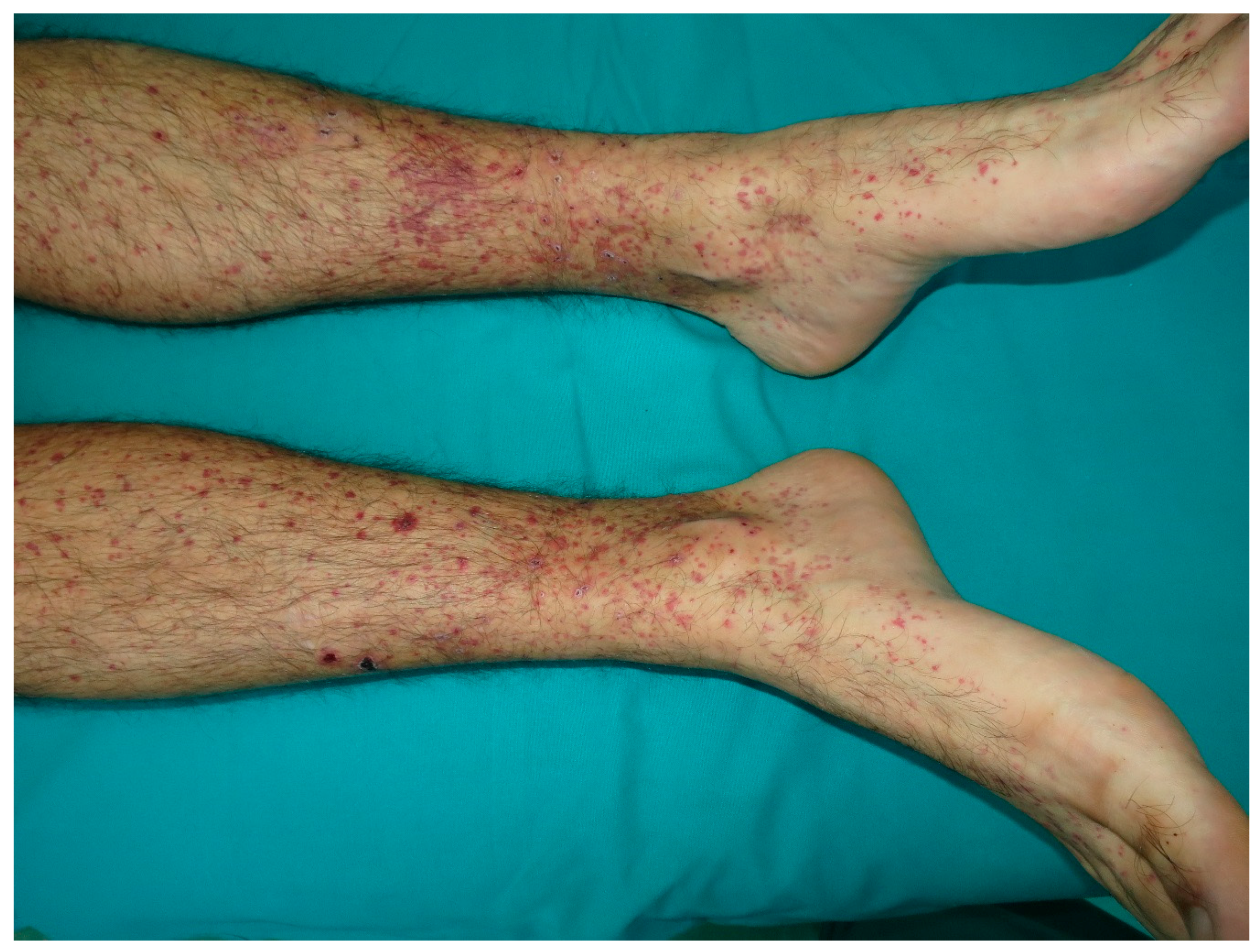 Nutrients 10 00800 g008