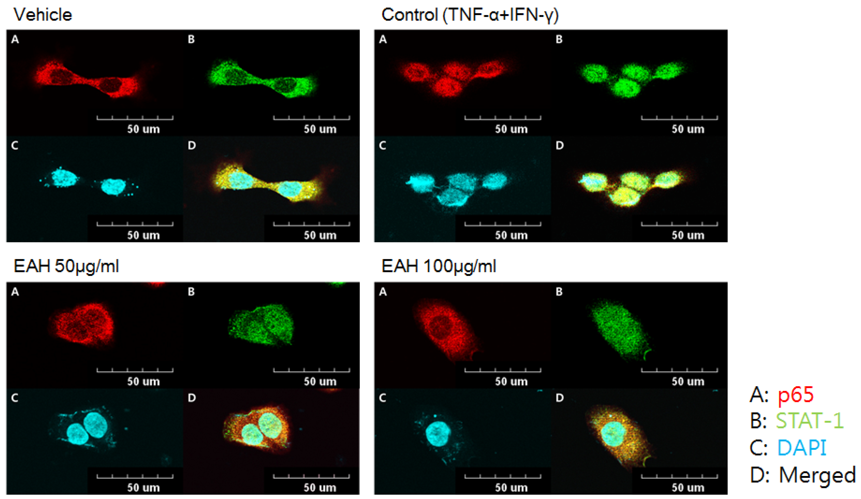 Nutrients 10 00806 g004