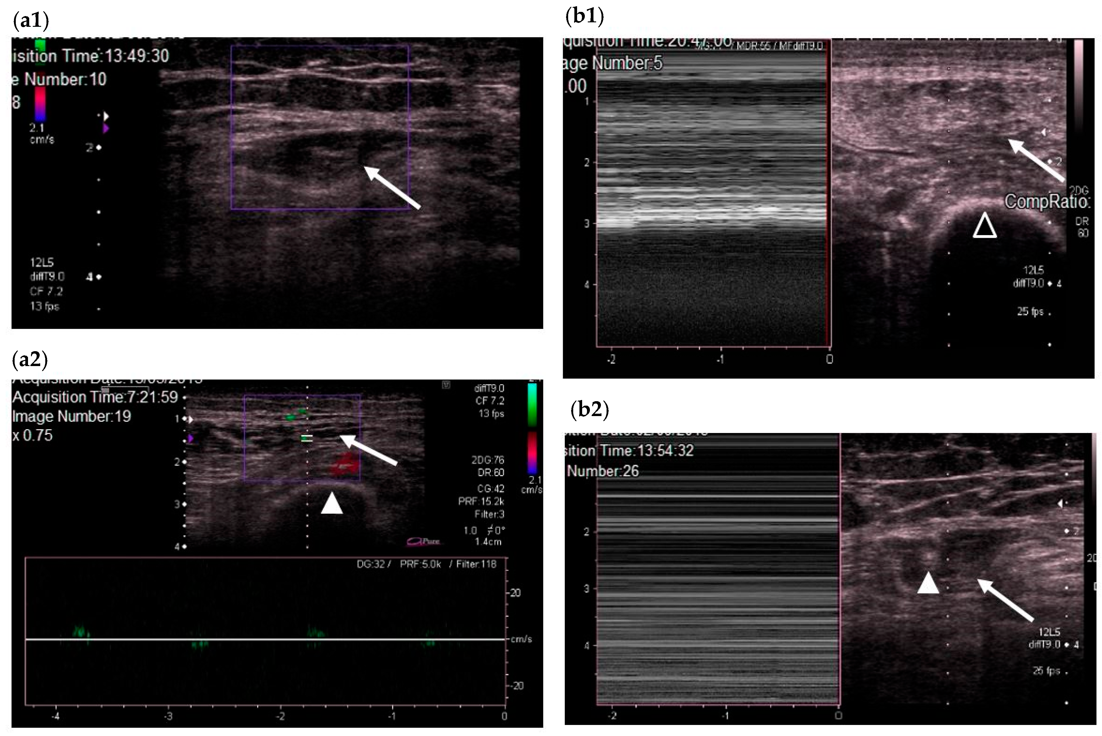 Nutrients 10 01849 g003