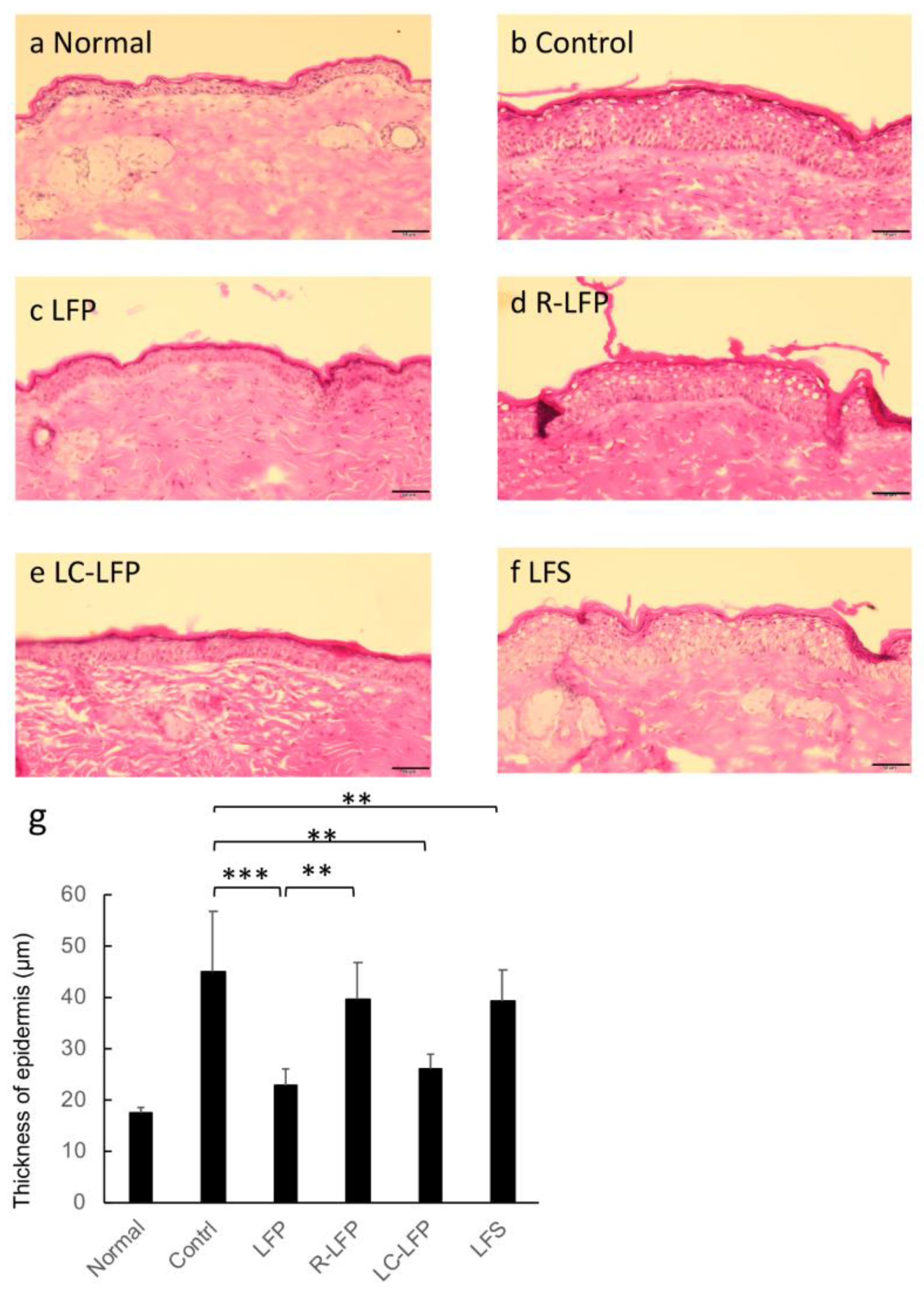 Nutrients 10 01858 g006