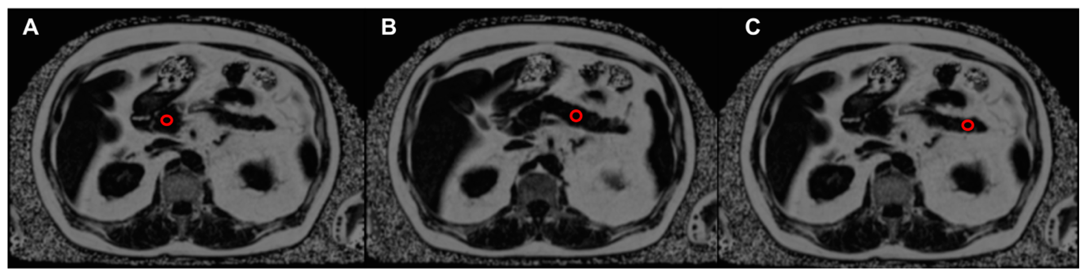 Nutrients 11 00912 g001