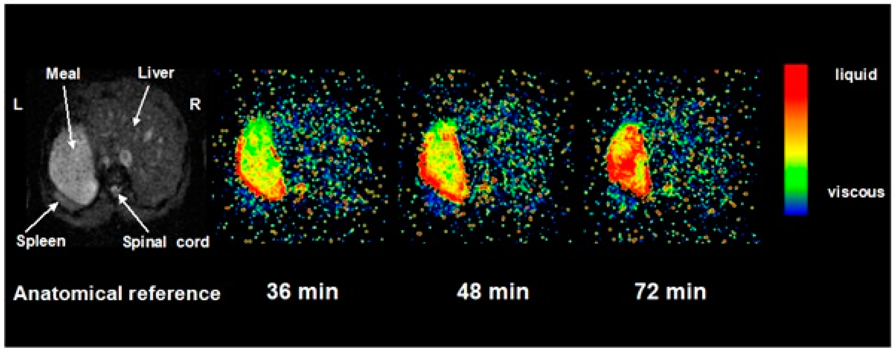 Nutrients 11 01147 g003