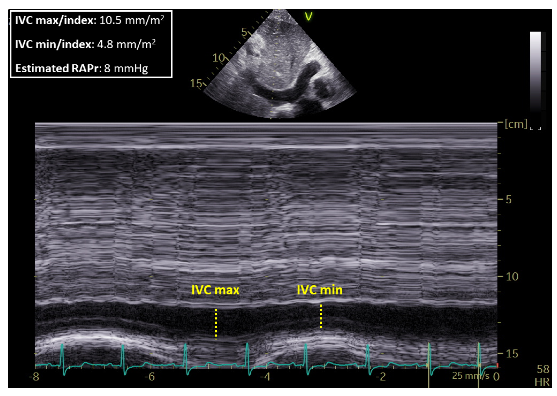 Nutrients 11 01587 g001