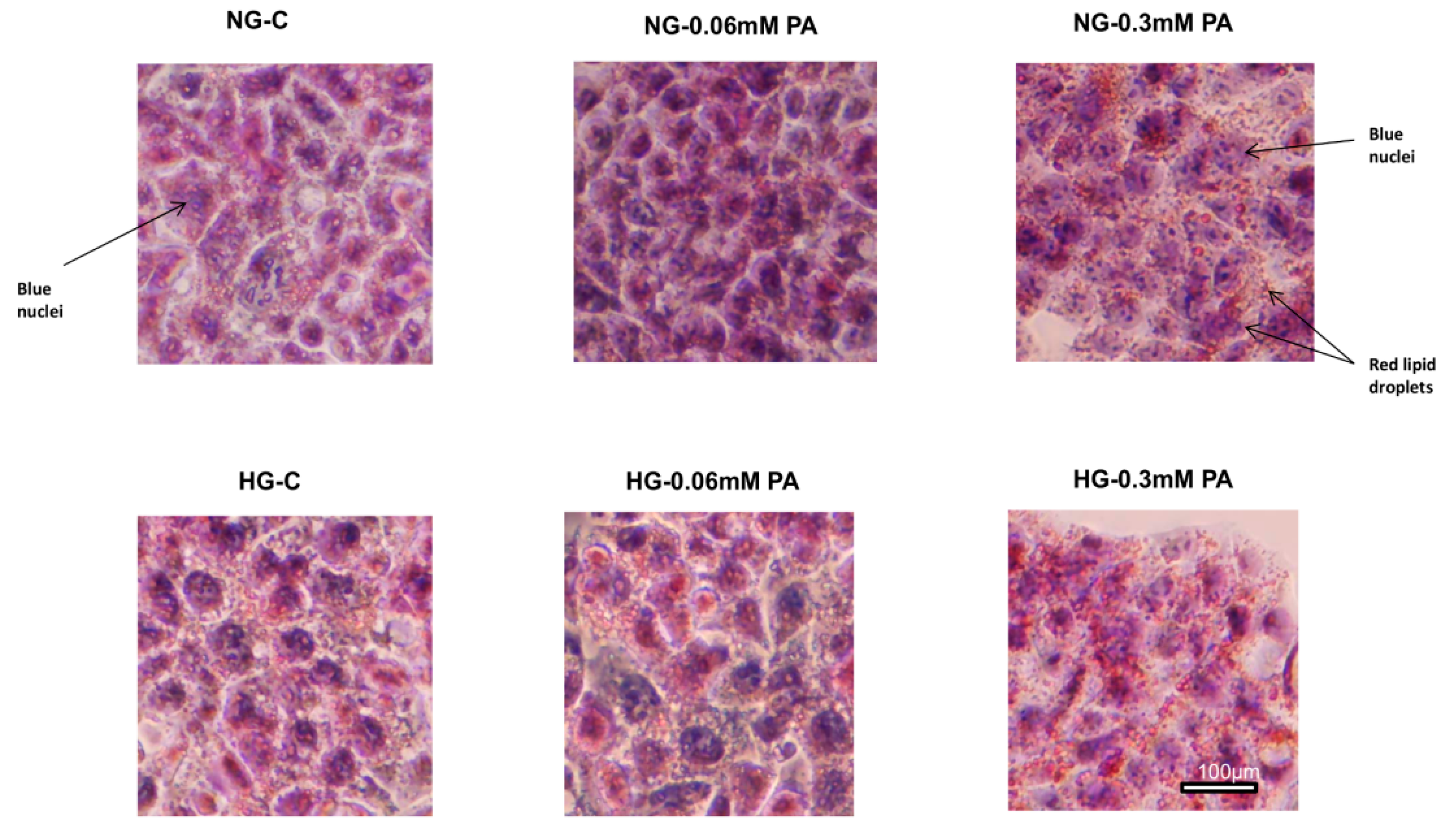 Nutrients 11 01979 g011