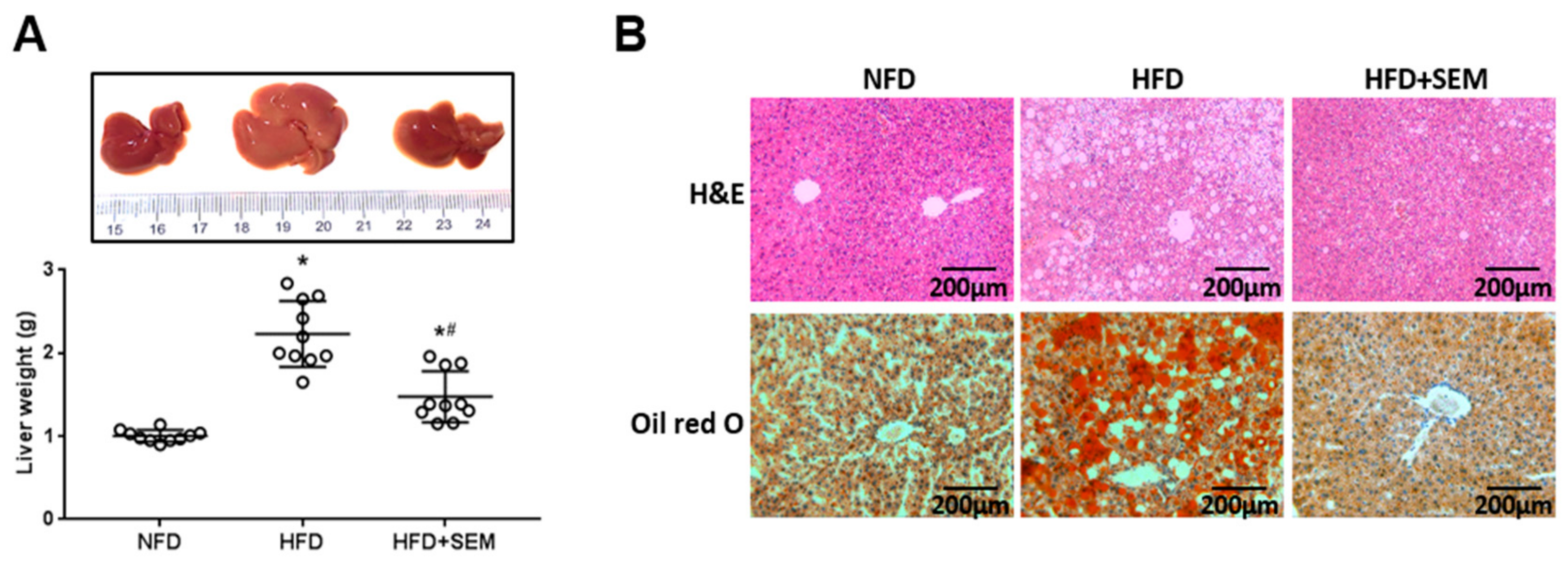 Nutrients 12 00329 g003