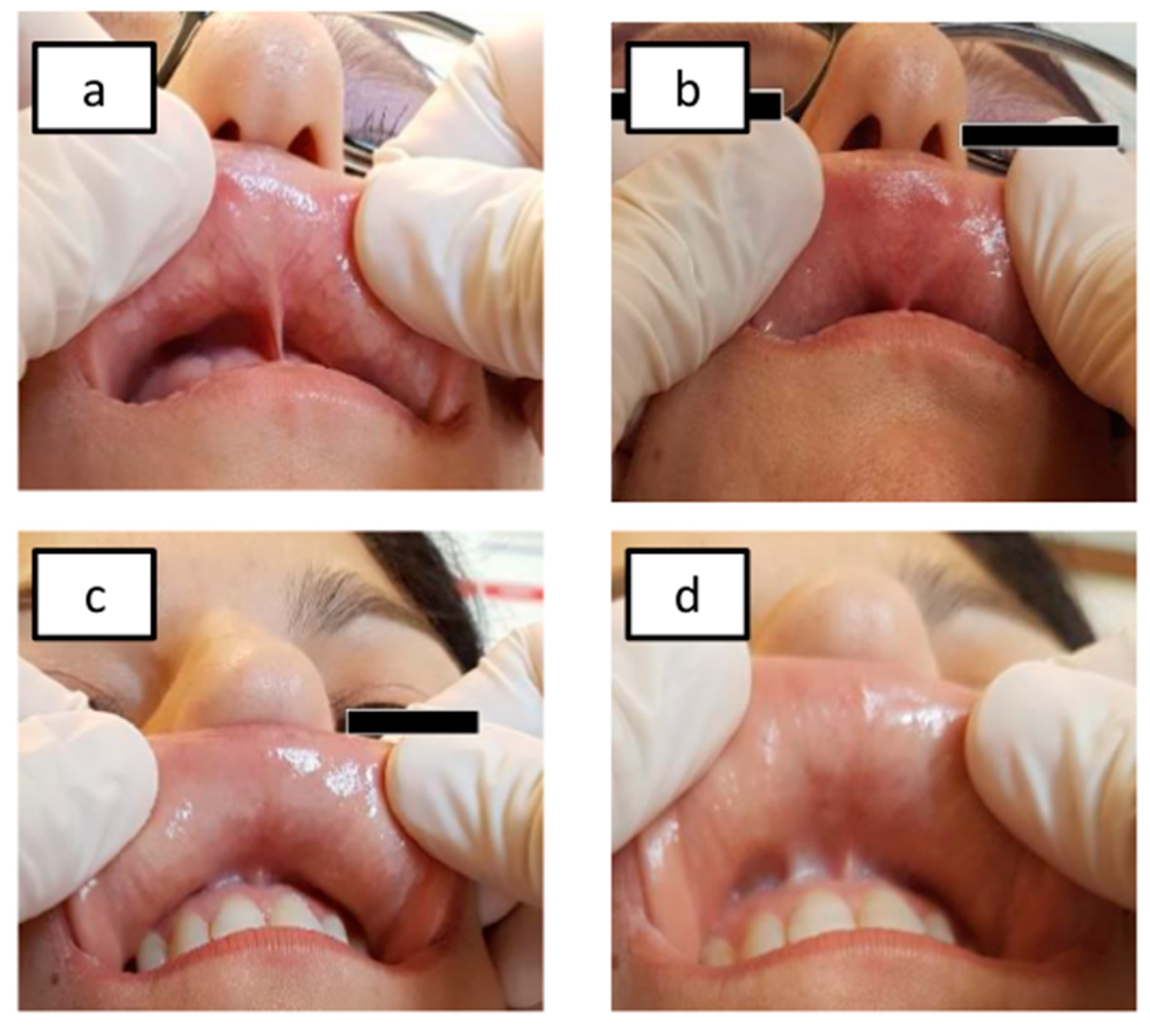 Nutrients 12 00341 g002
