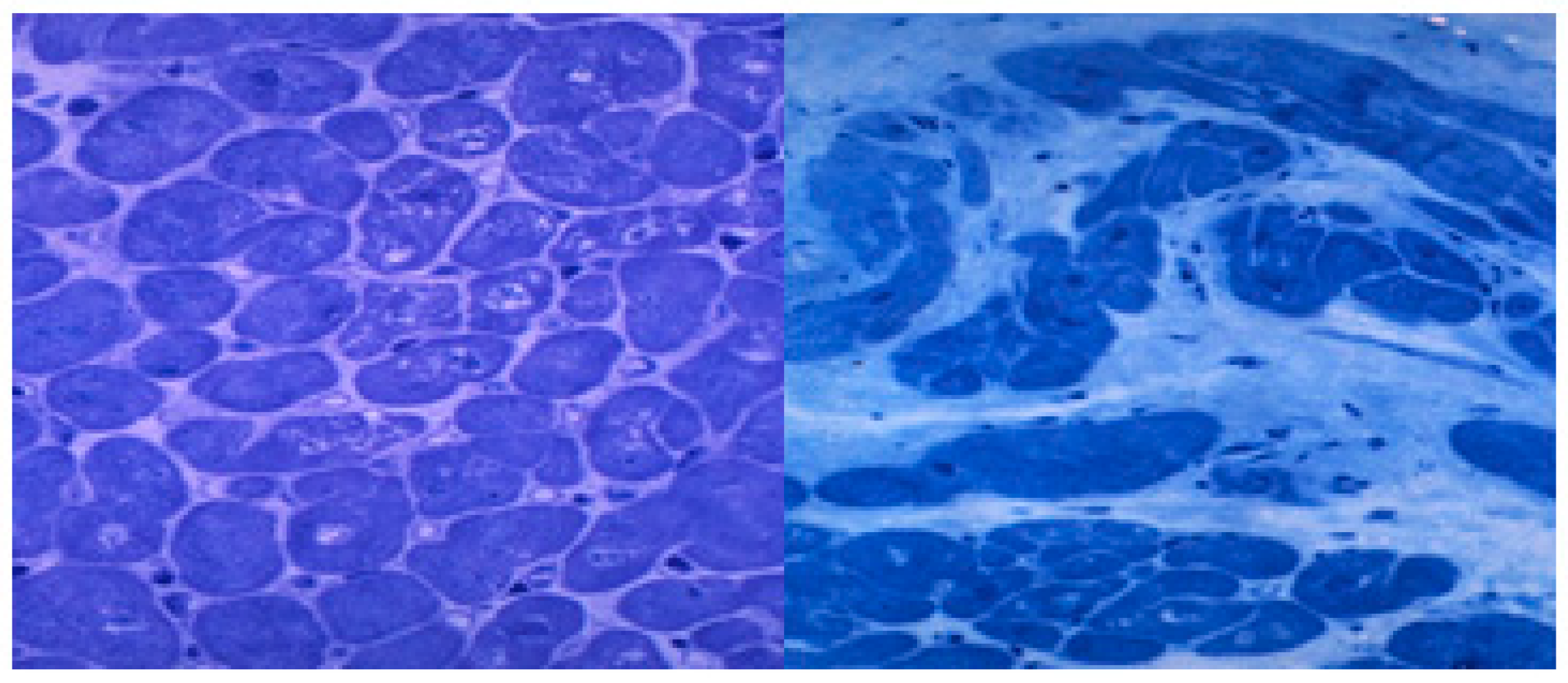 Nutrients 12 00572 g002