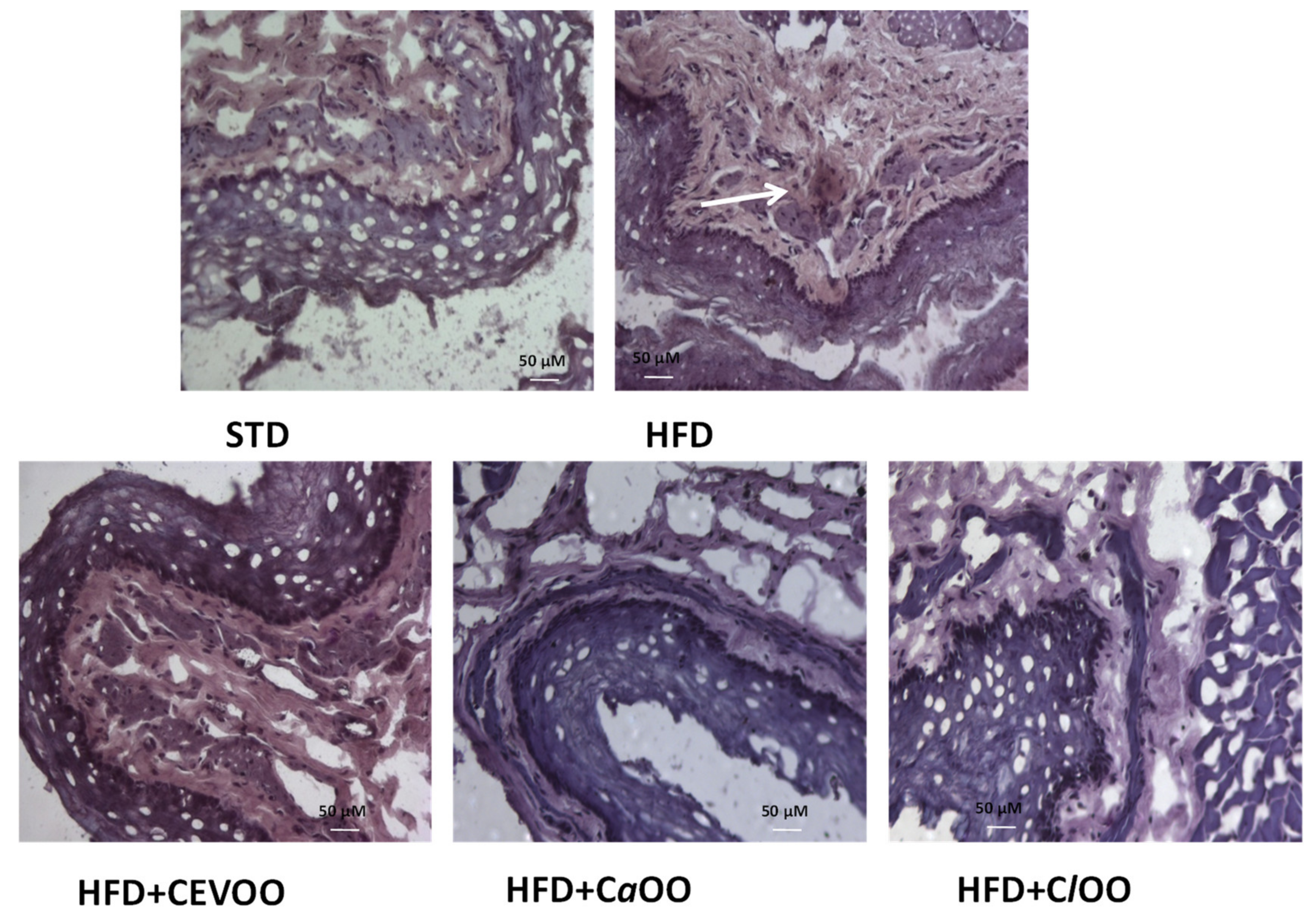 Nutrients 12 01557 g012