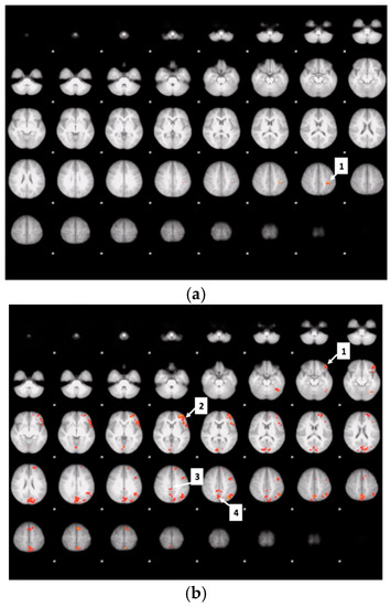 Nutrients 12 03283 g0a2