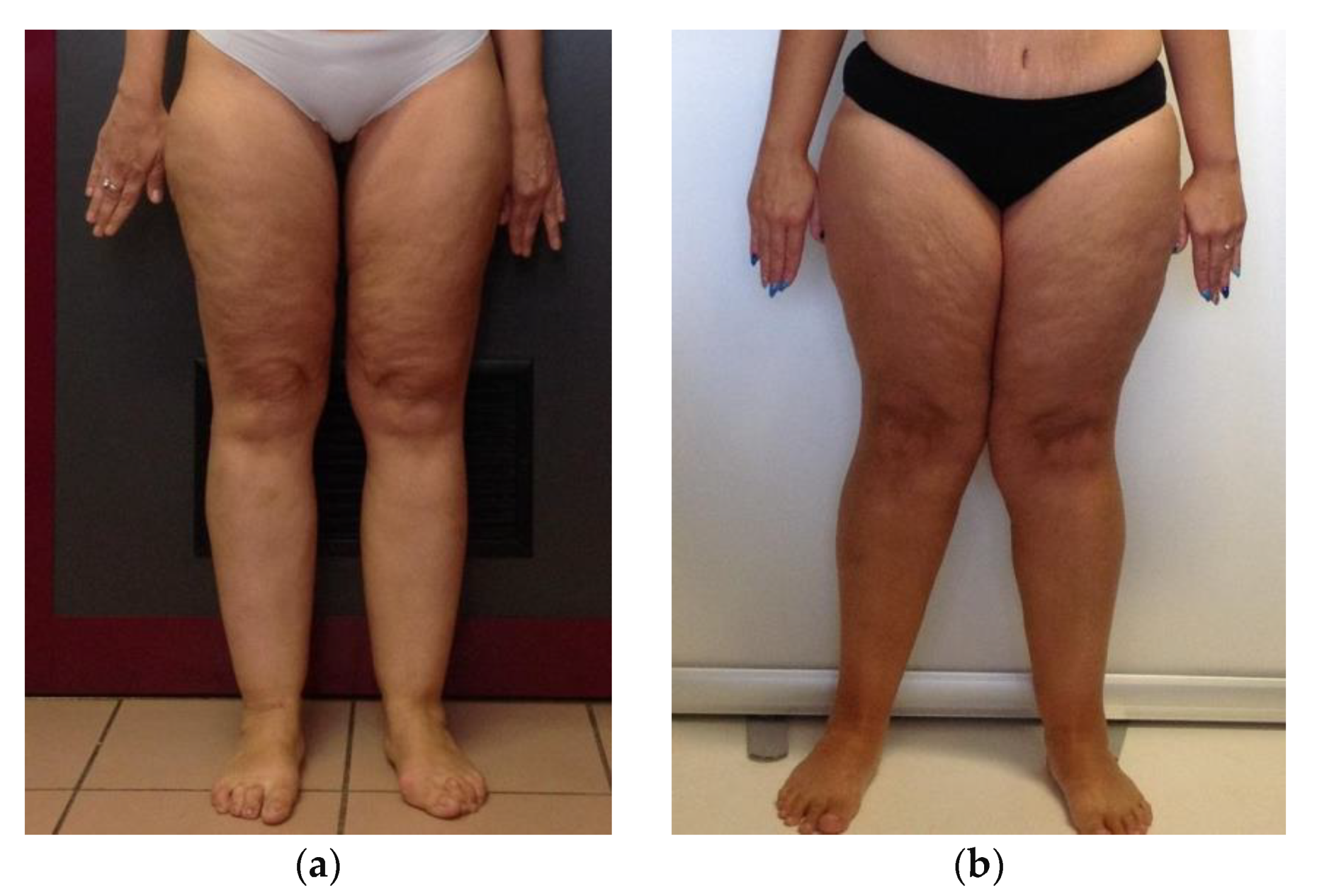 Nutrients 13 00358 g001a