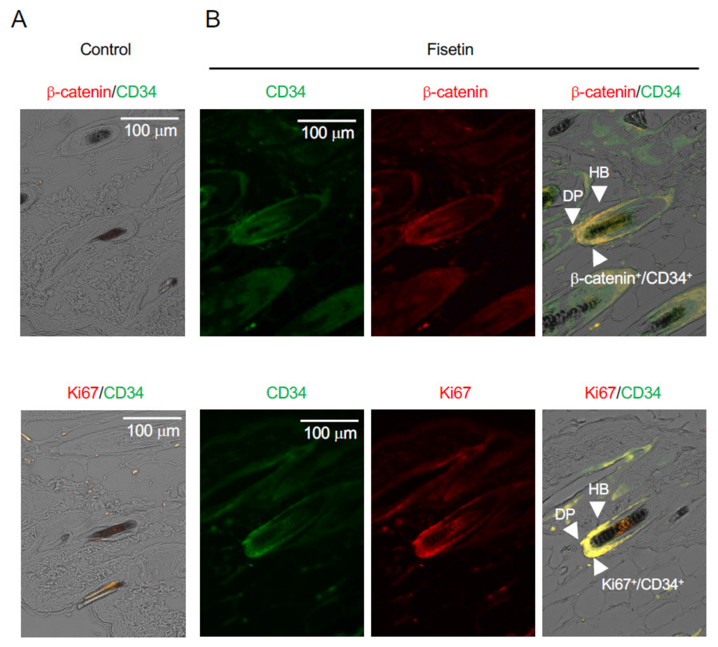 Nutrients 13 02087 g002 Nutrients 13 02087 g002