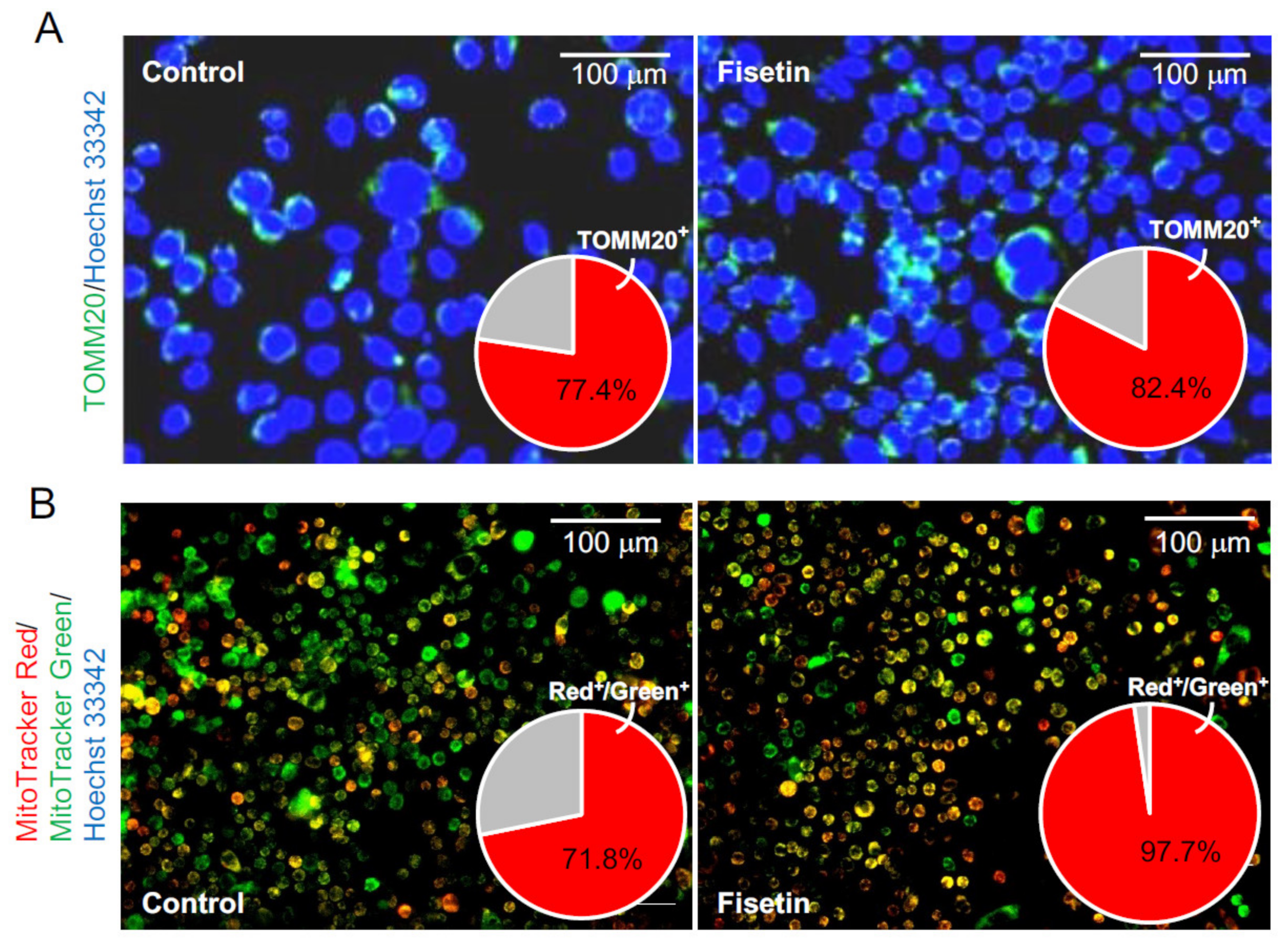 Nutrients 13 02087 g005 Nutrients 13 02087 g005