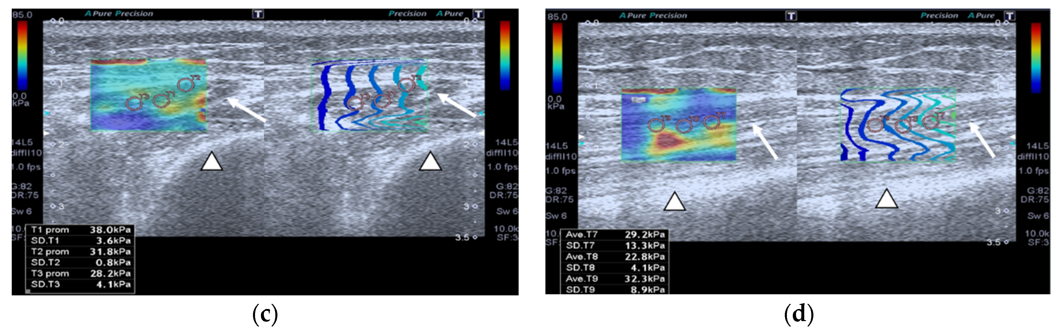 Nutrients 13 02224 g001b