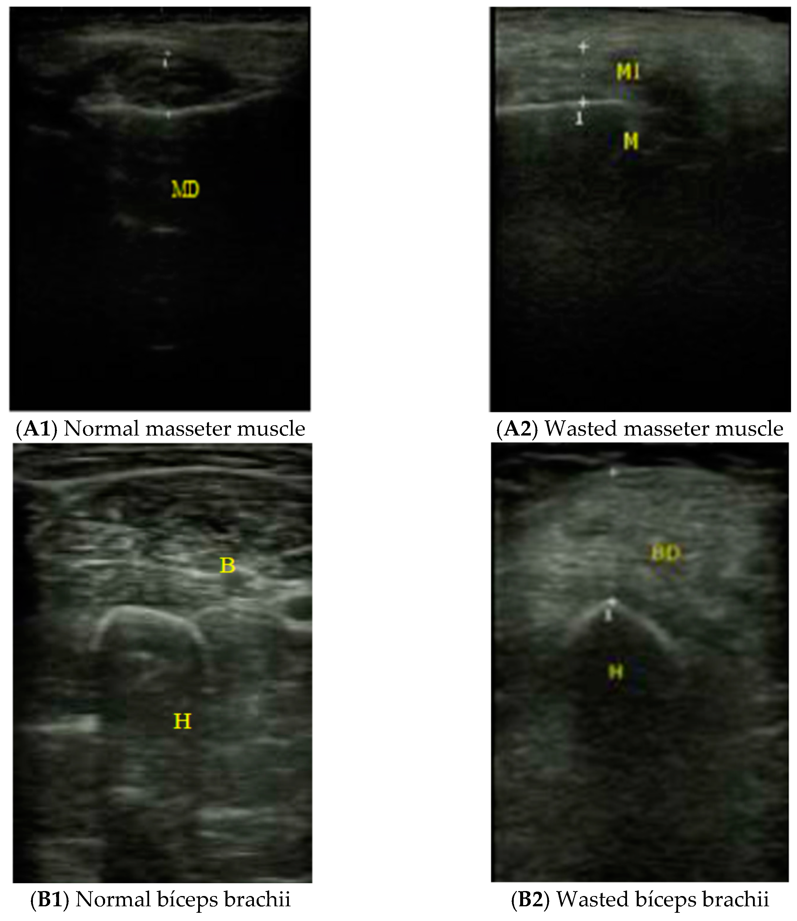 Nutrients 13 02401 g001a Nutrients 13 02401 g001a