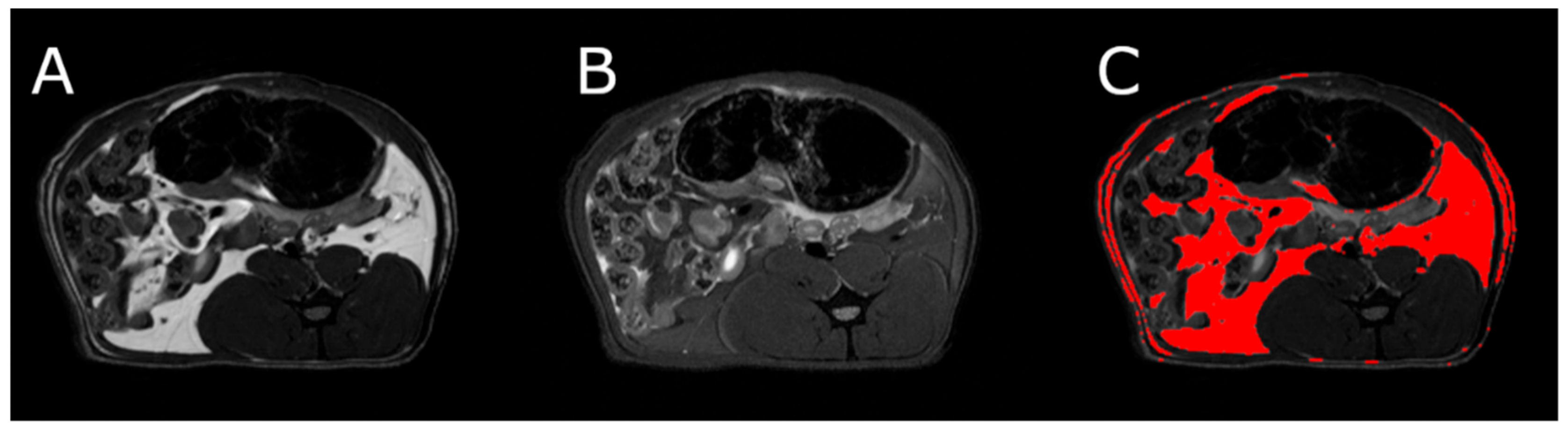 Nutrients 13 02876 g005 Nutrients 13 02876 g005