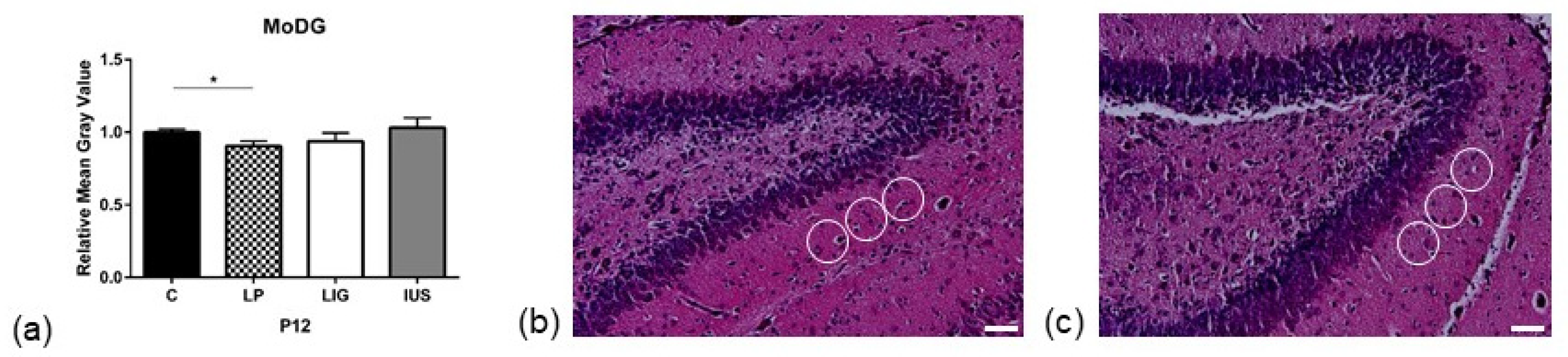 Nutrients 14 00451 g002 Nutrients 14 00451 g002