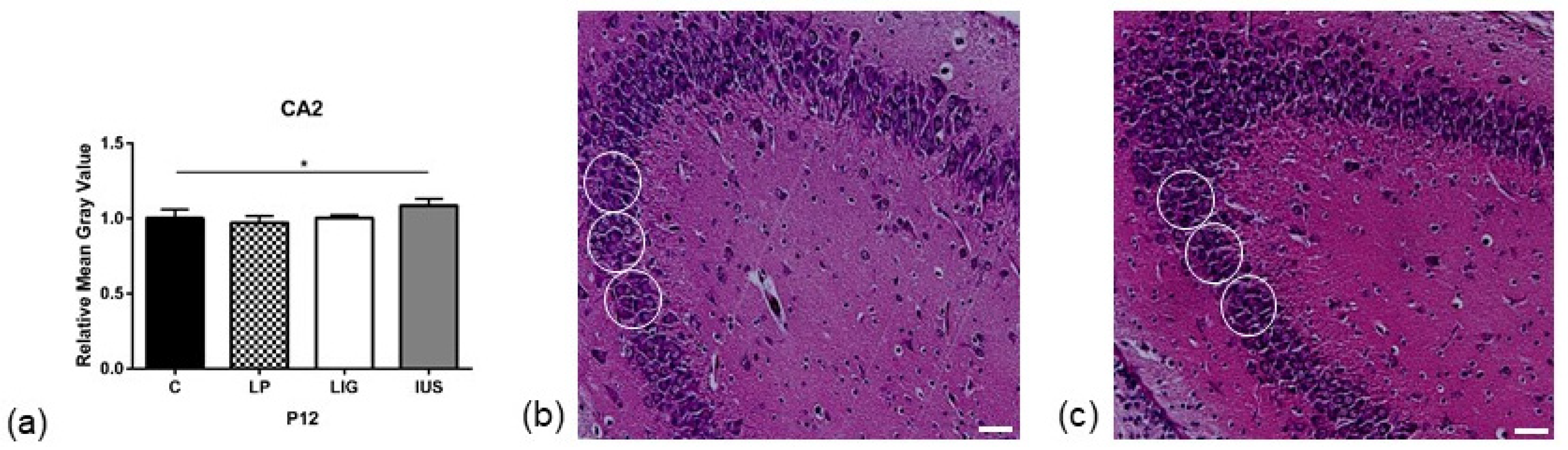 Nutrients 14 00451 g003 Nutrients 14 00451 g003