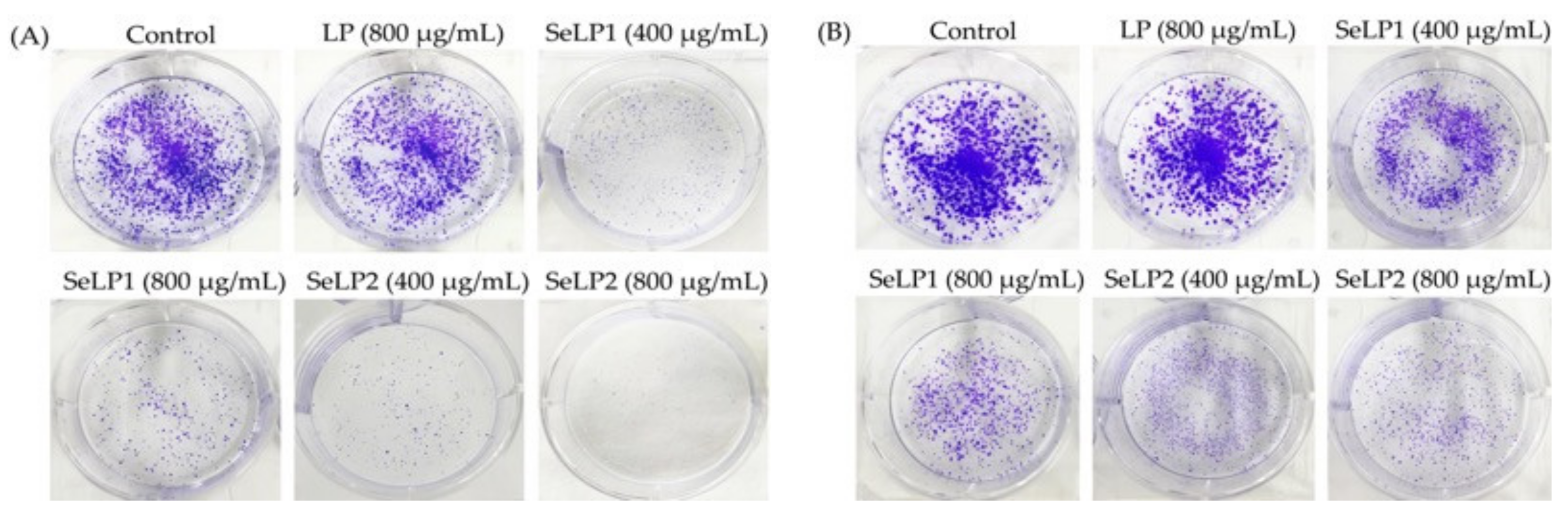 Nutrients 14 01710 g003 Nutrients 14 01710 g003