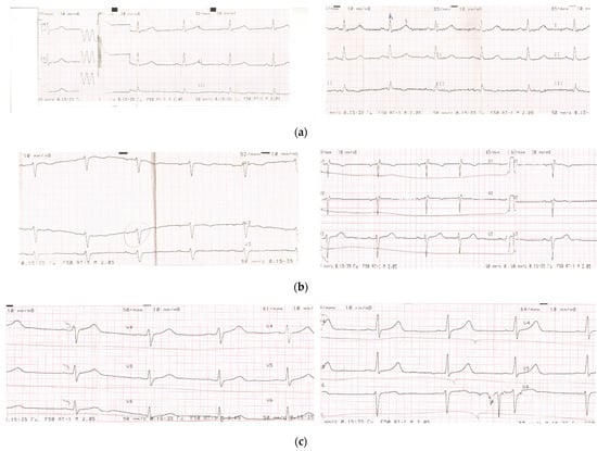 Nutrients 14 02203 g0a1