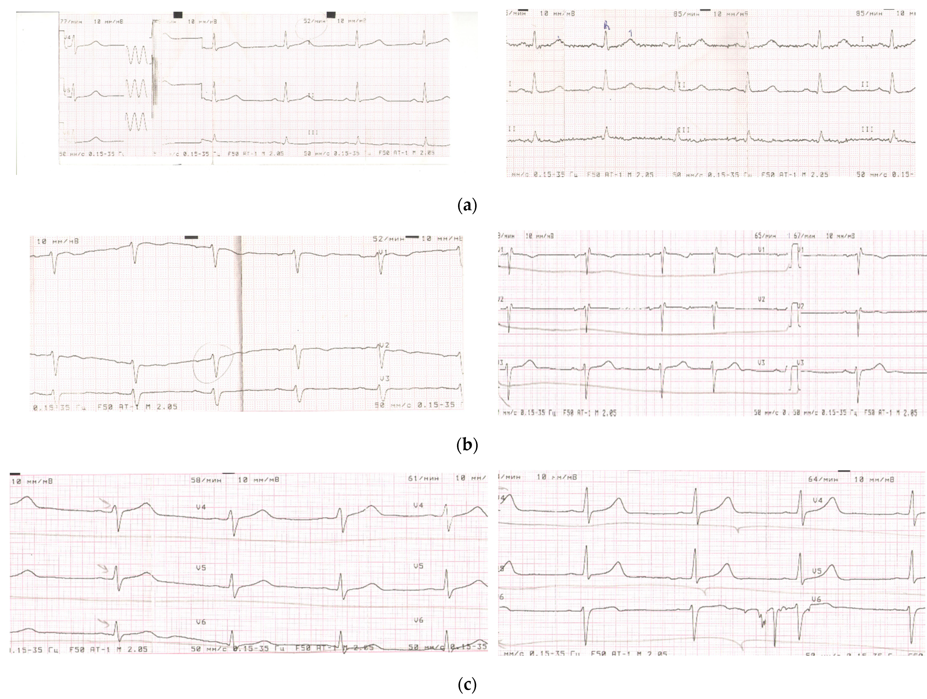 Nutrients 14 02203 g0a1