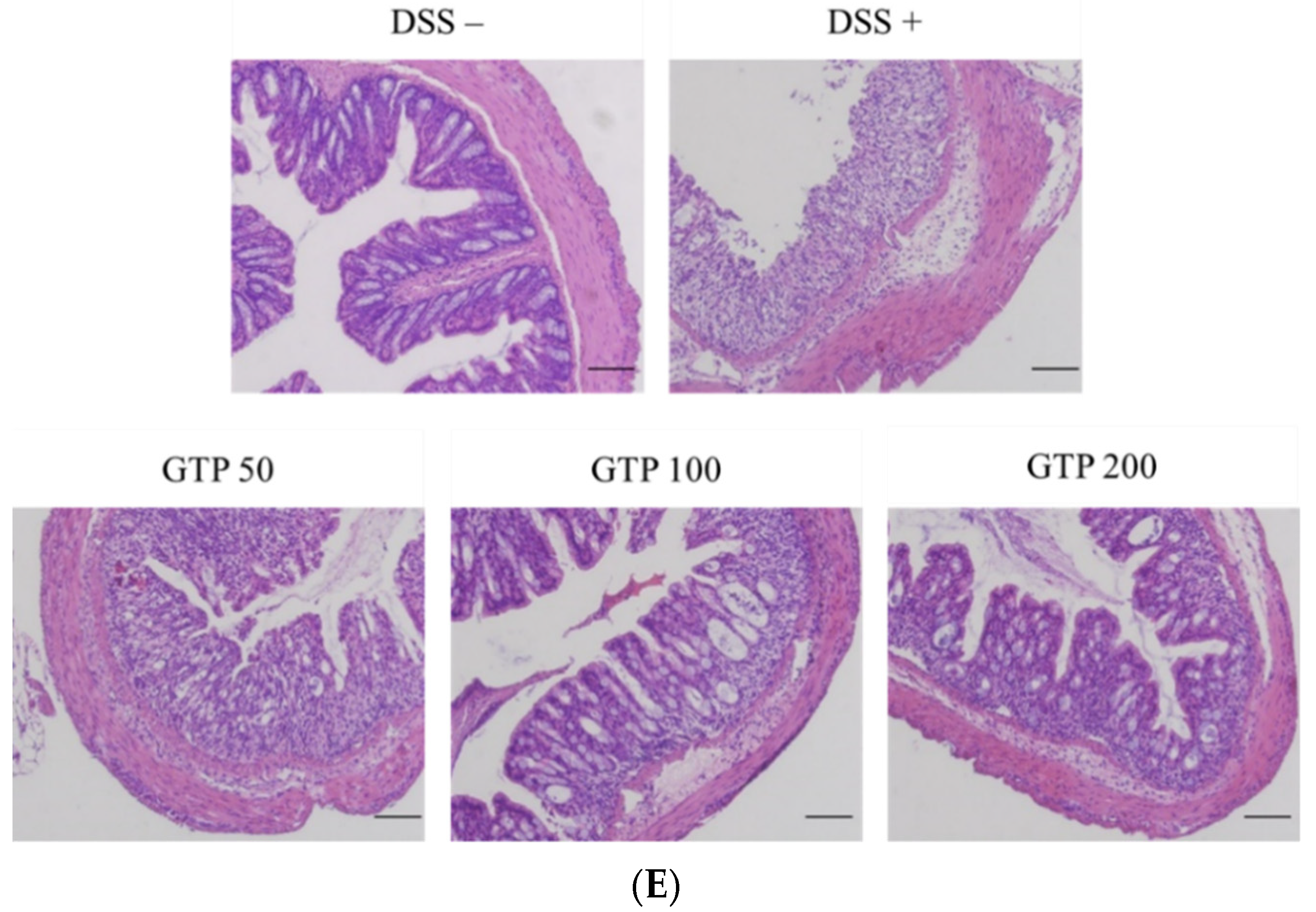 Nutrients 14 02684 g004b Nutrients 14 02684 g004b