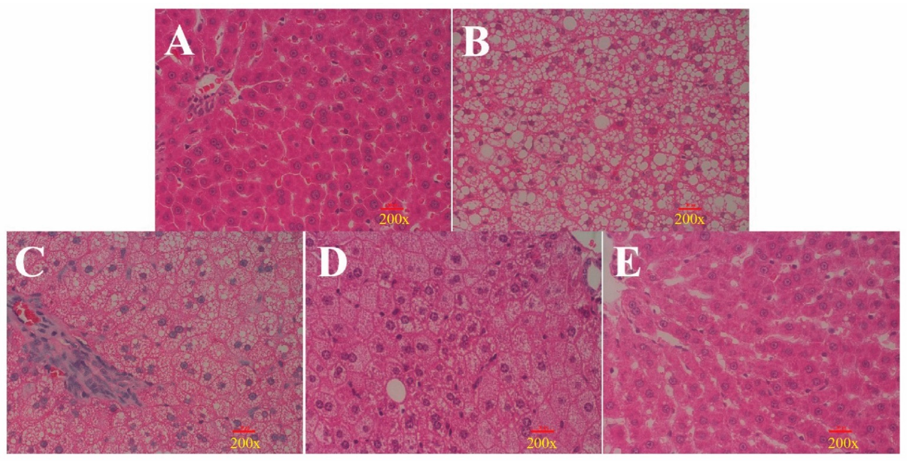 Nutrients 14 04092 g005 Nutrients 14 04092 g005