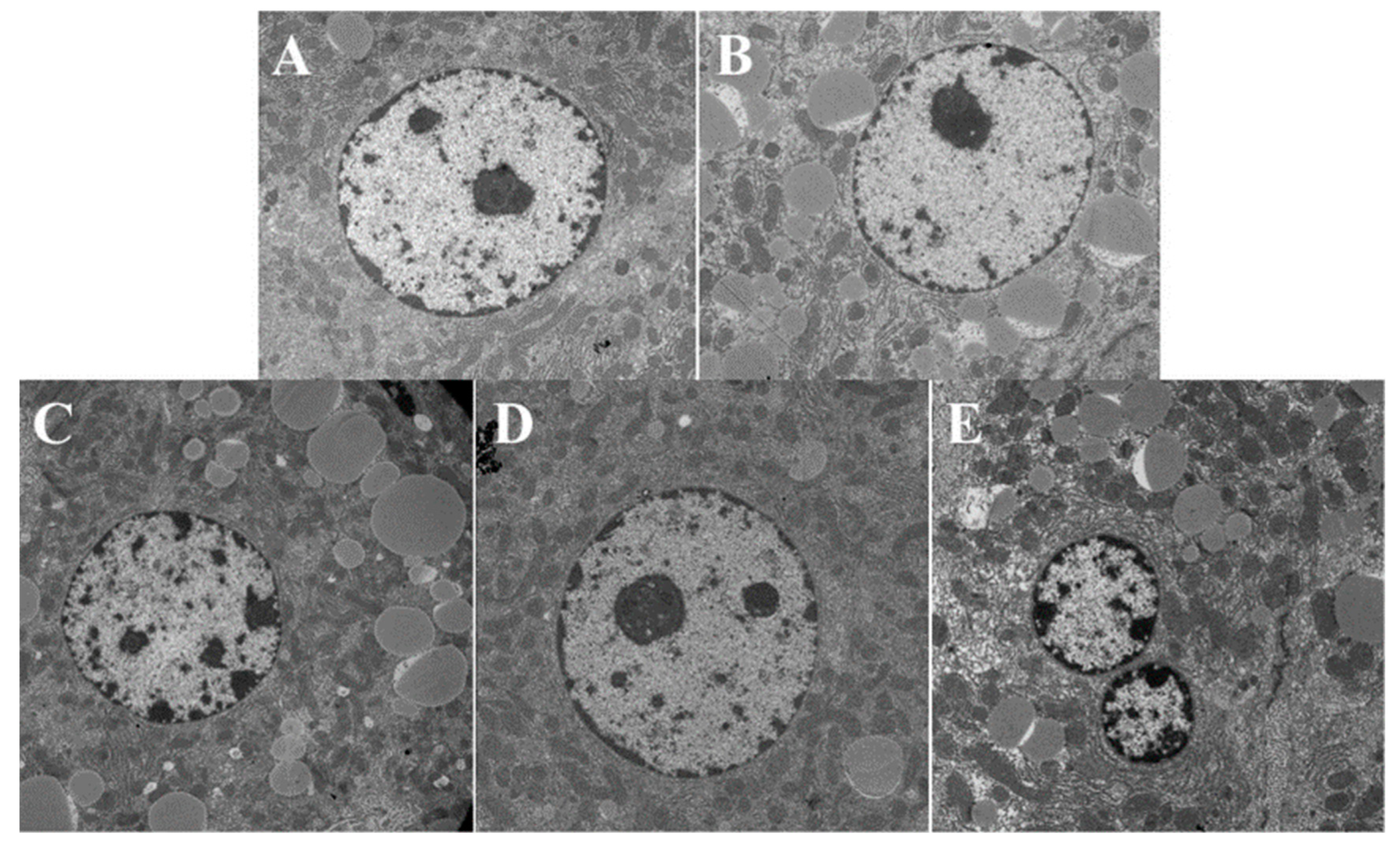 Nutrients 14 04092 g006 Nutrients 14 04092 g006