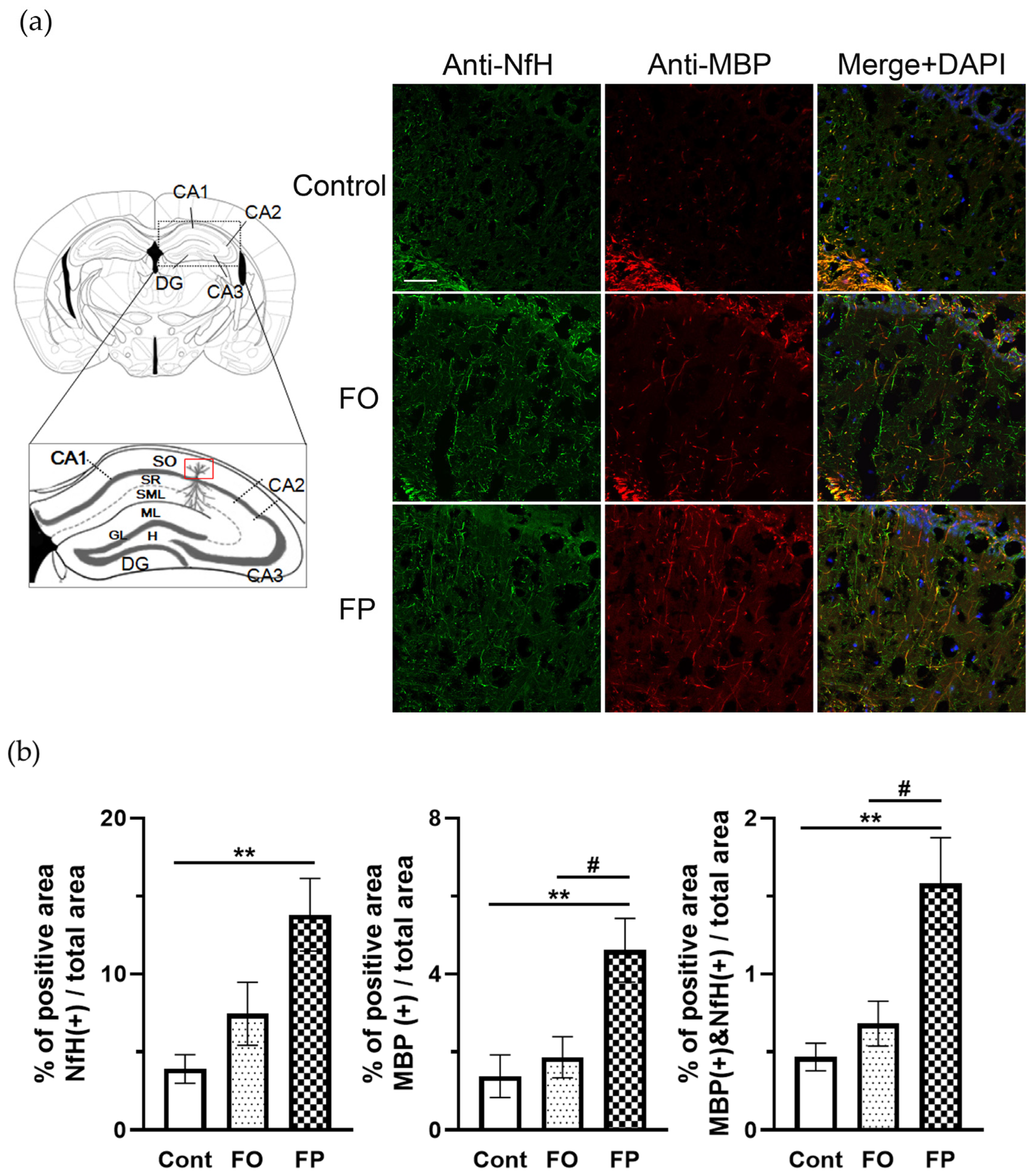Nutrients 14 04618 g003 Nutrients 14 04618 g003