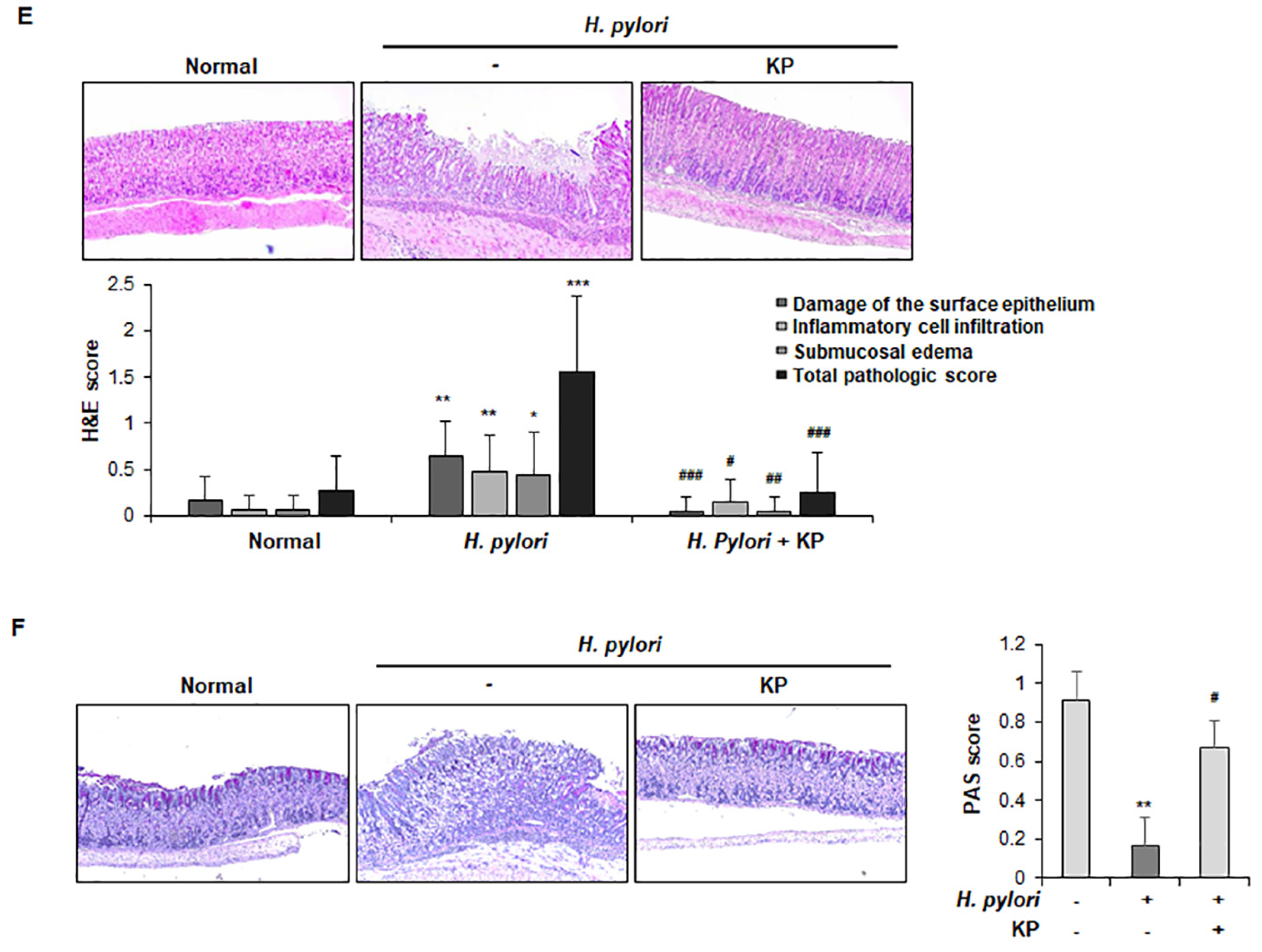 Nutrients 14 04644 g001b Nutrients 14 04644 g001b