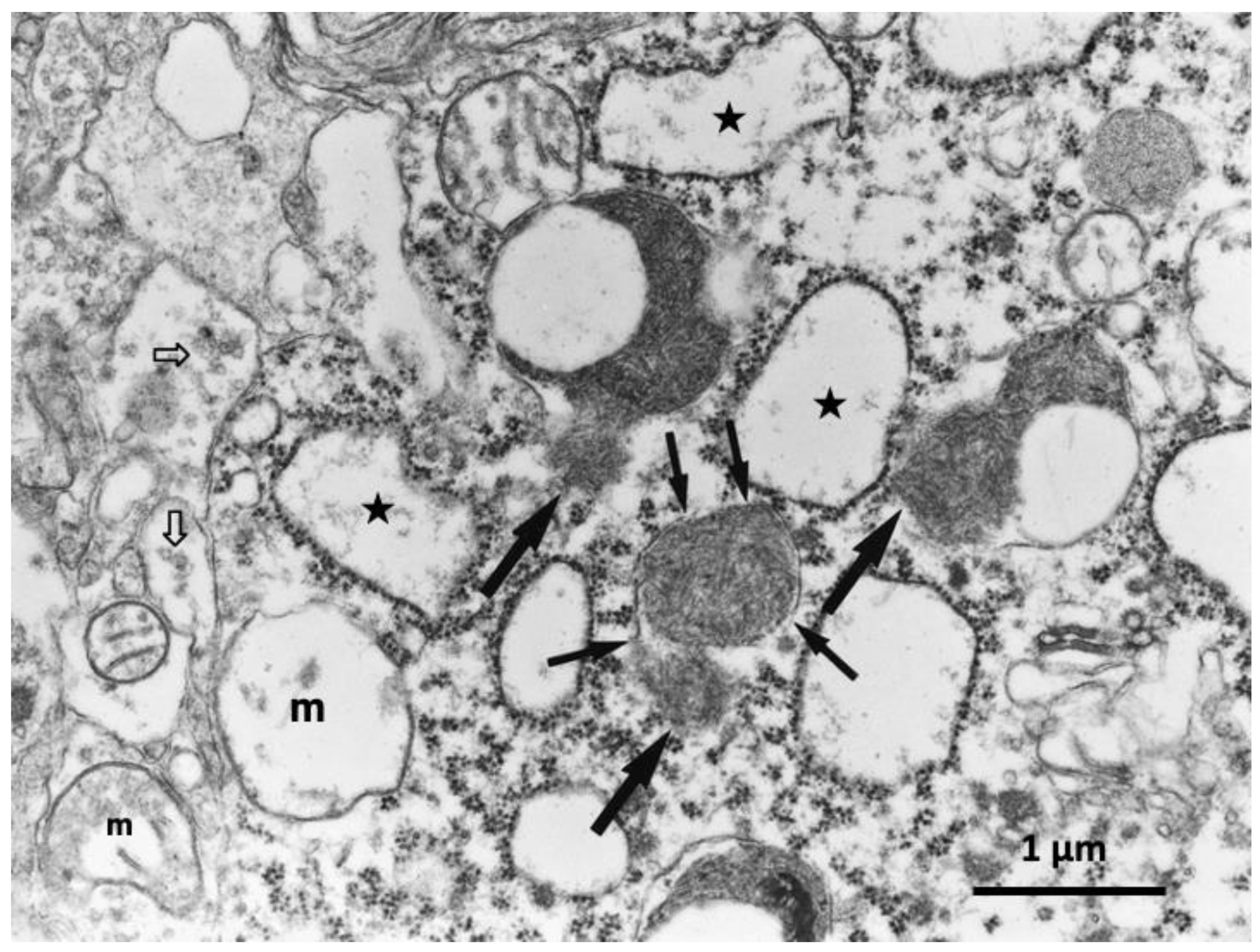Nutrients 15 00609 g006