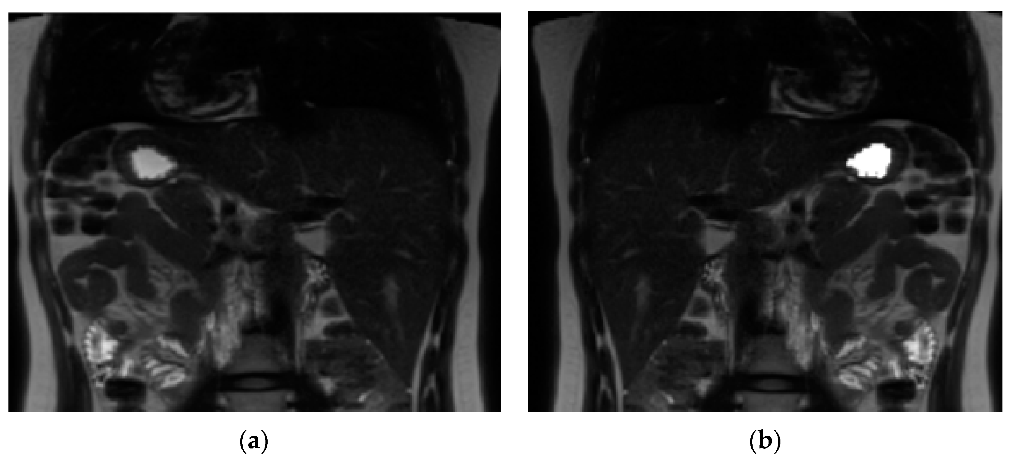 Nutrients 15 00801 g002
