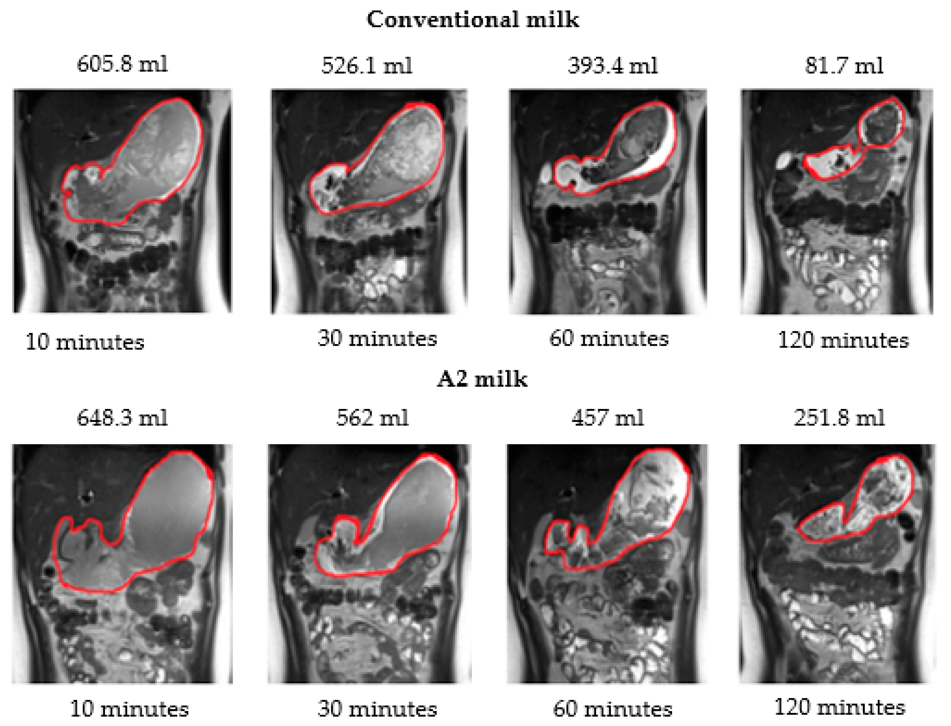 Nutrients 15 00801 g005