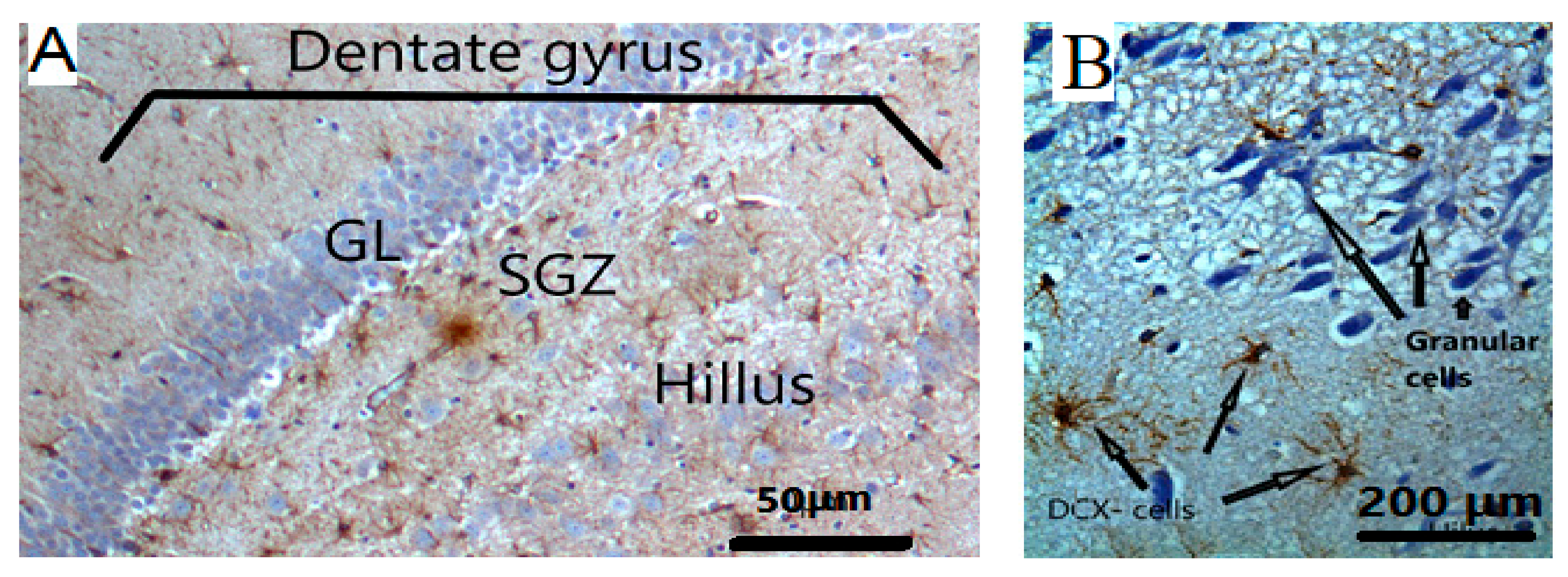 Nutrients 15 01547 g007 Nutrients 15 01547 g007
