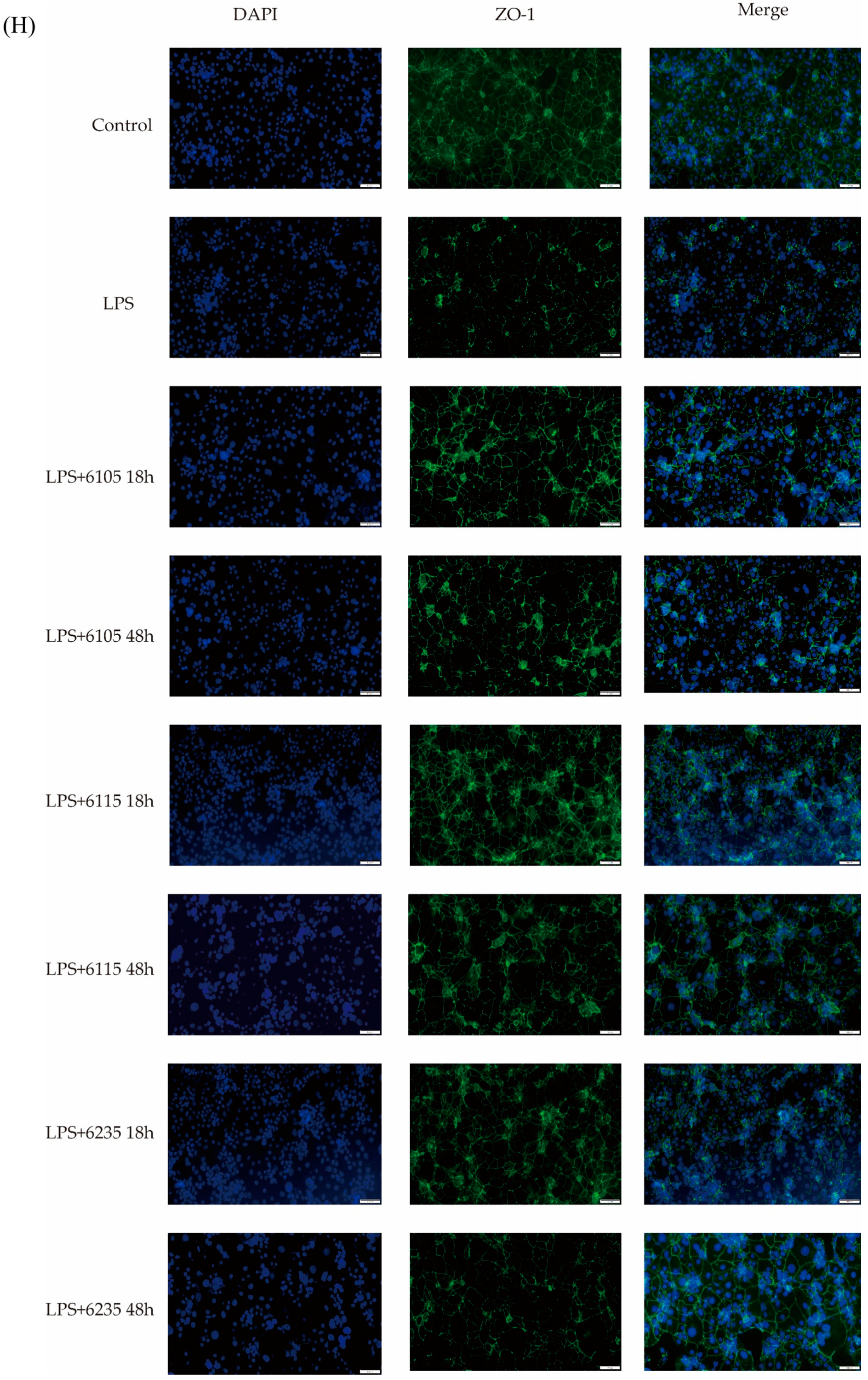 Nutrients 15 01758 g004b Nutrients 15 01758 g004b